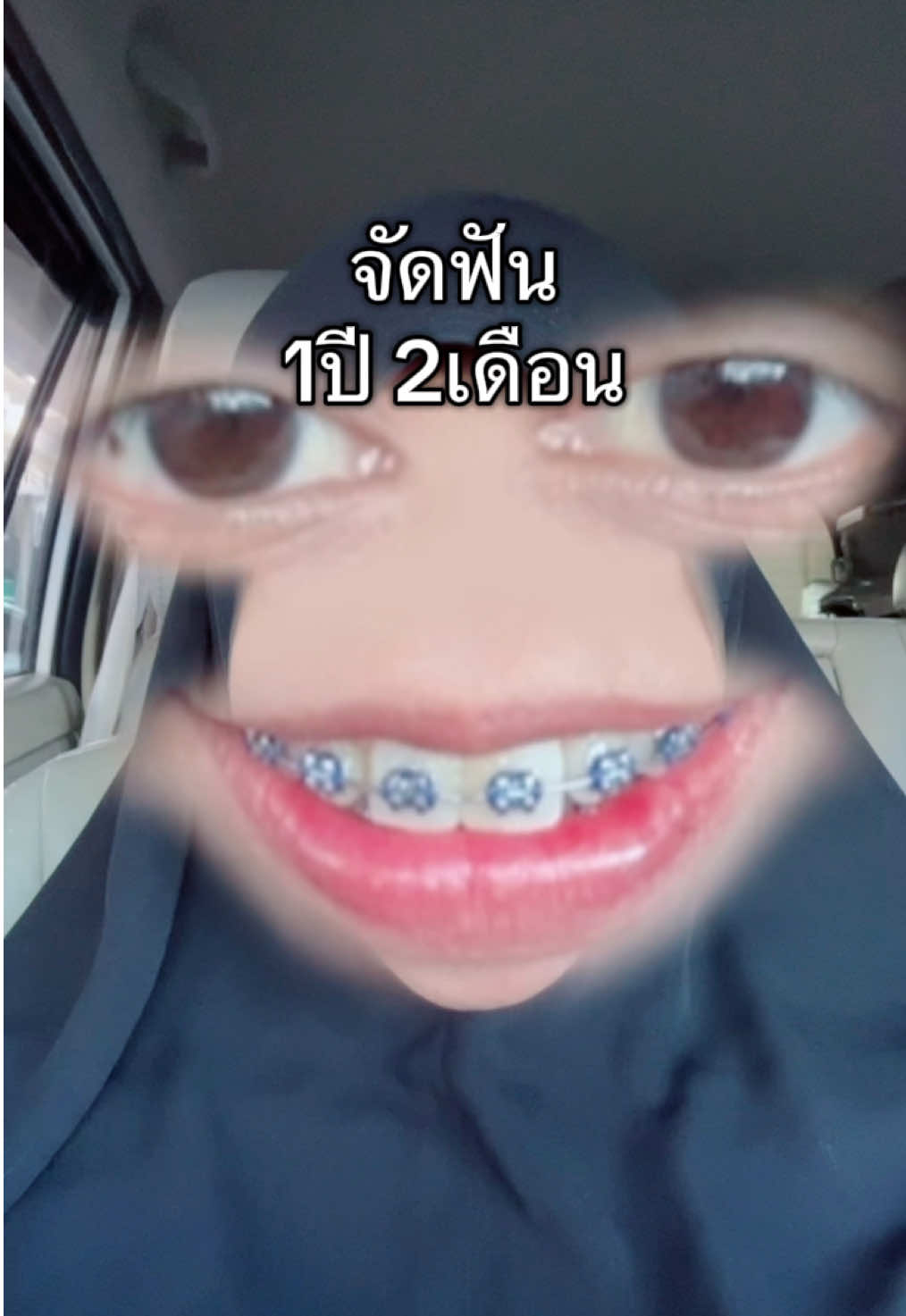 @ฟาตินฟันกระต่ายอ้ะะ🐰