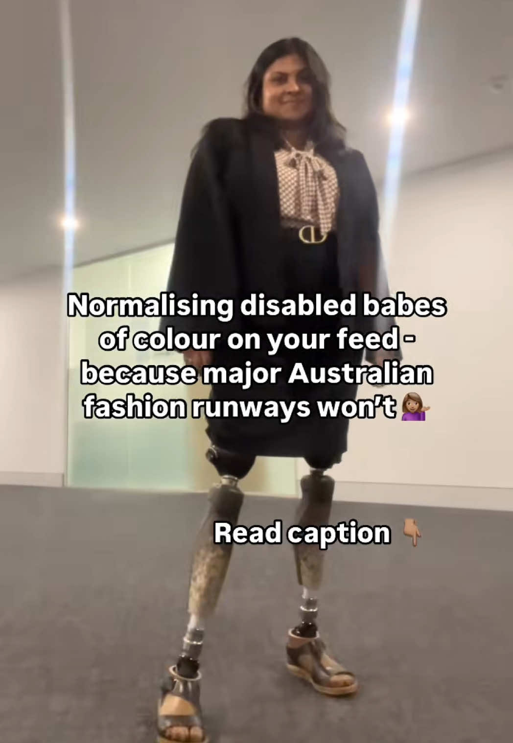 @NoLegs_NoWorries