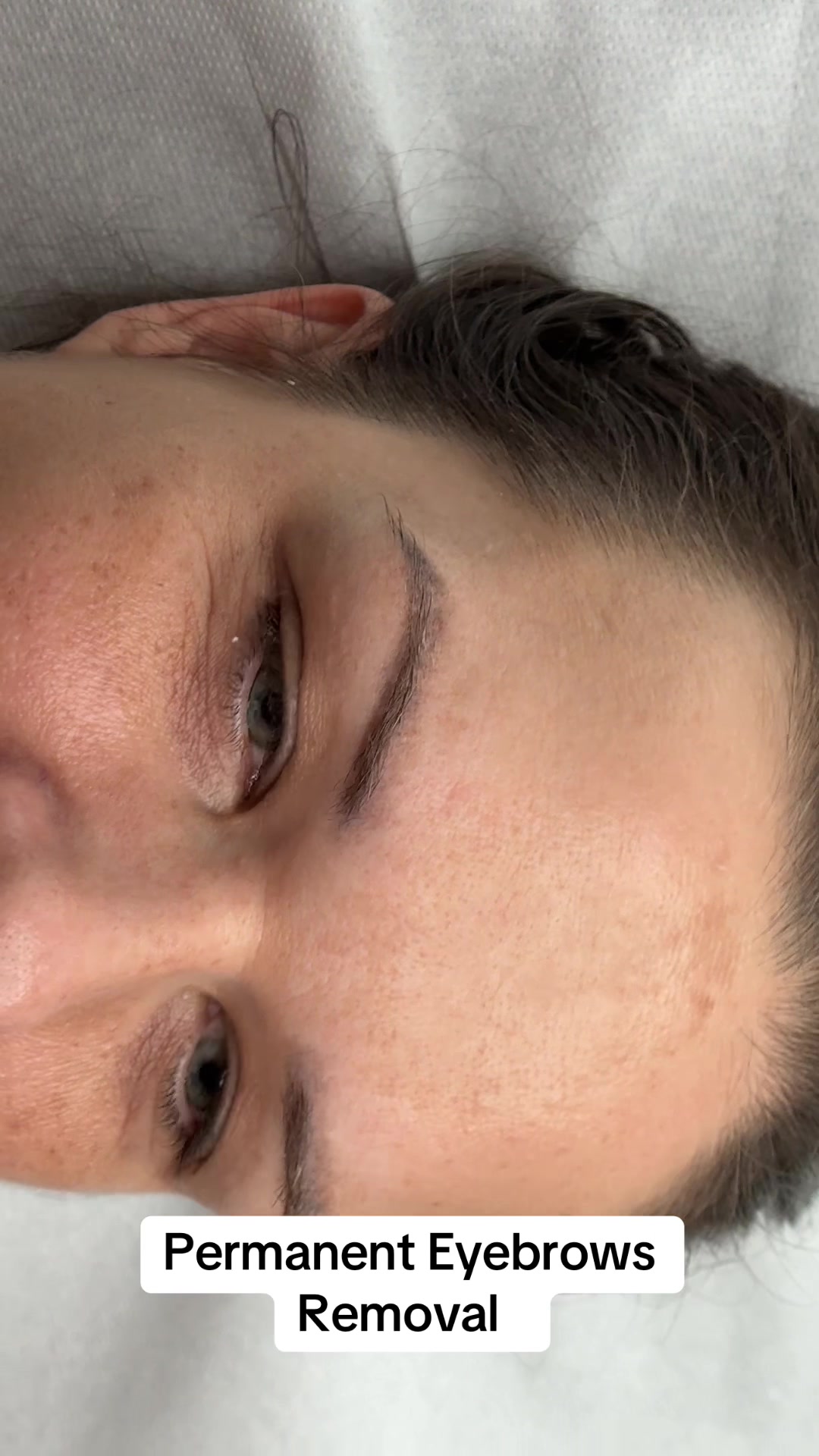 @Permanent Makeup & Removal