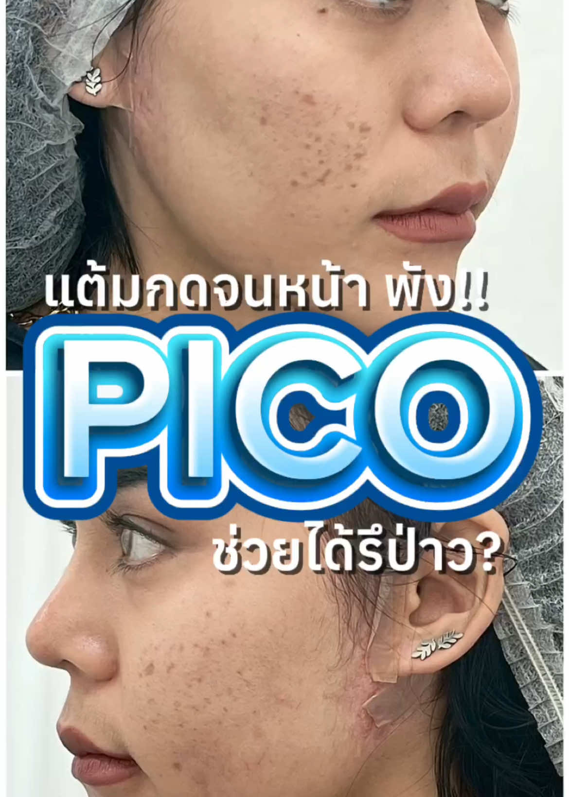 @กองจู พัทยา