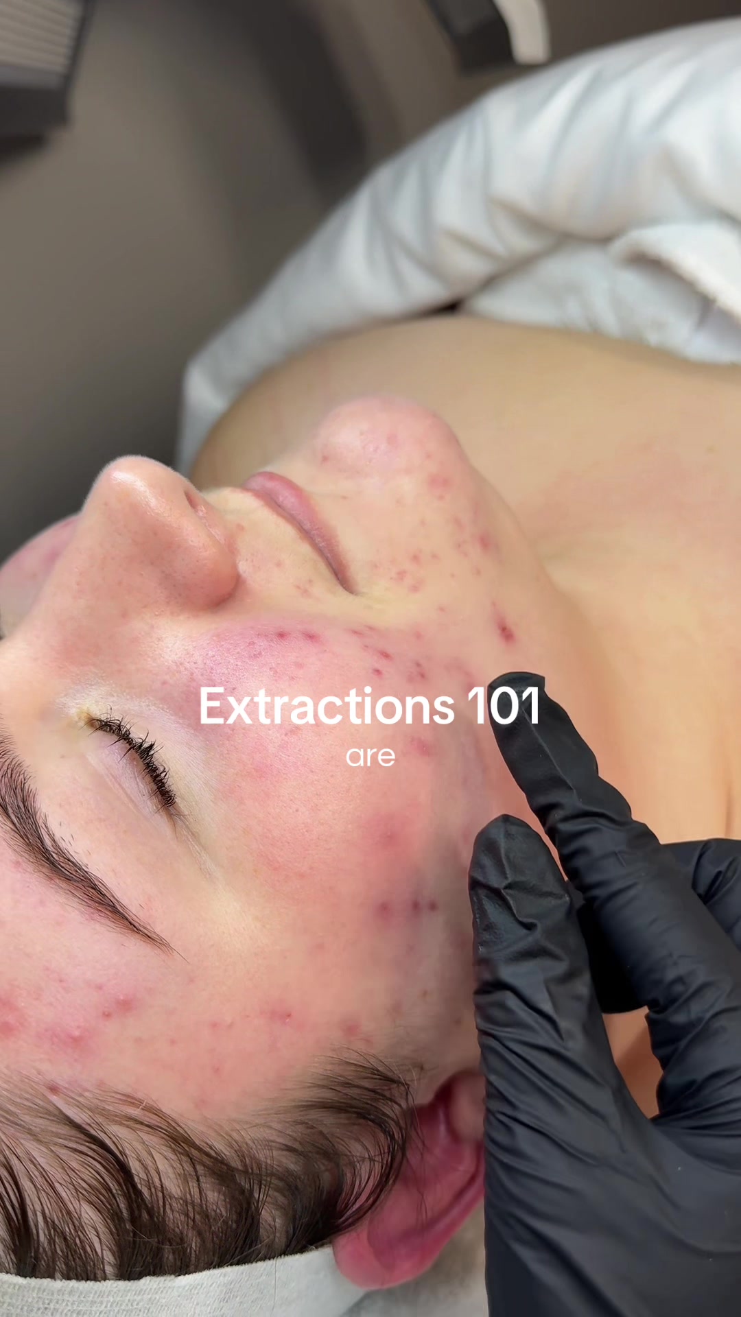 @Skinformative