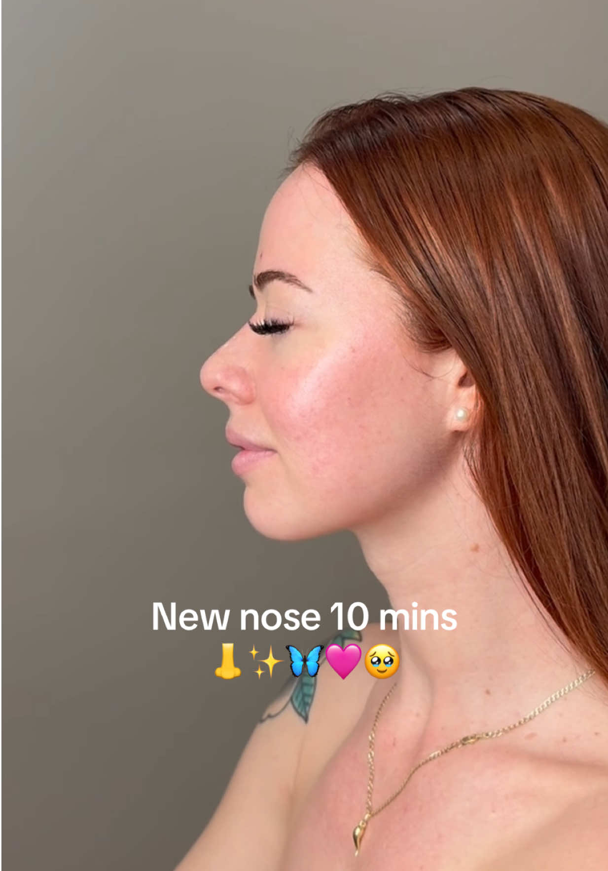 @THENOSENURSEOFFICIAL