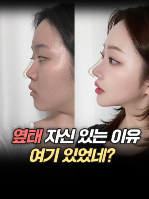 @디에이성형외과