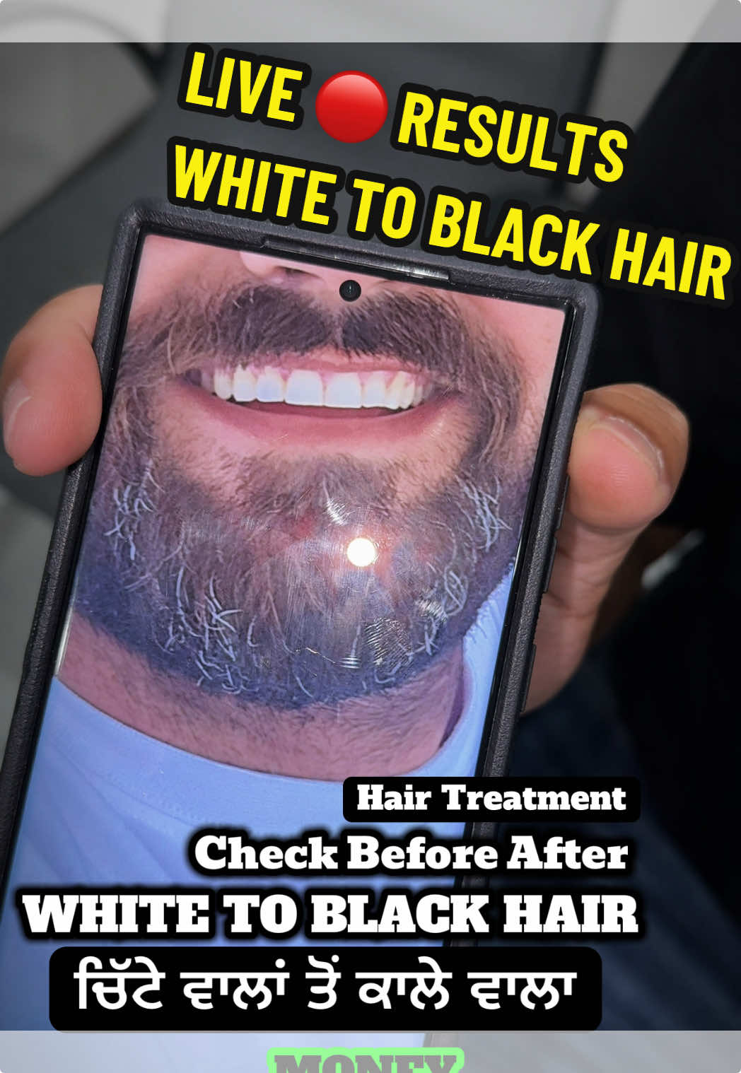 @money_beard_growthoil