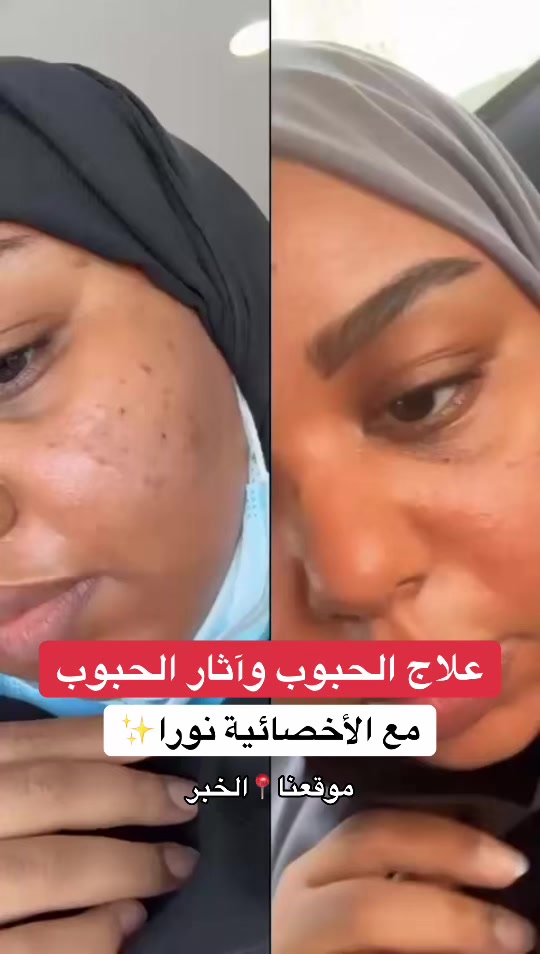 @أخصائية البشرة نورا