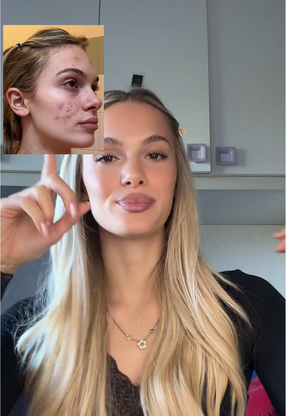 @𝐹𝐸𝐷𝐸𝑅𝐼𝐶𝐴👸🏼