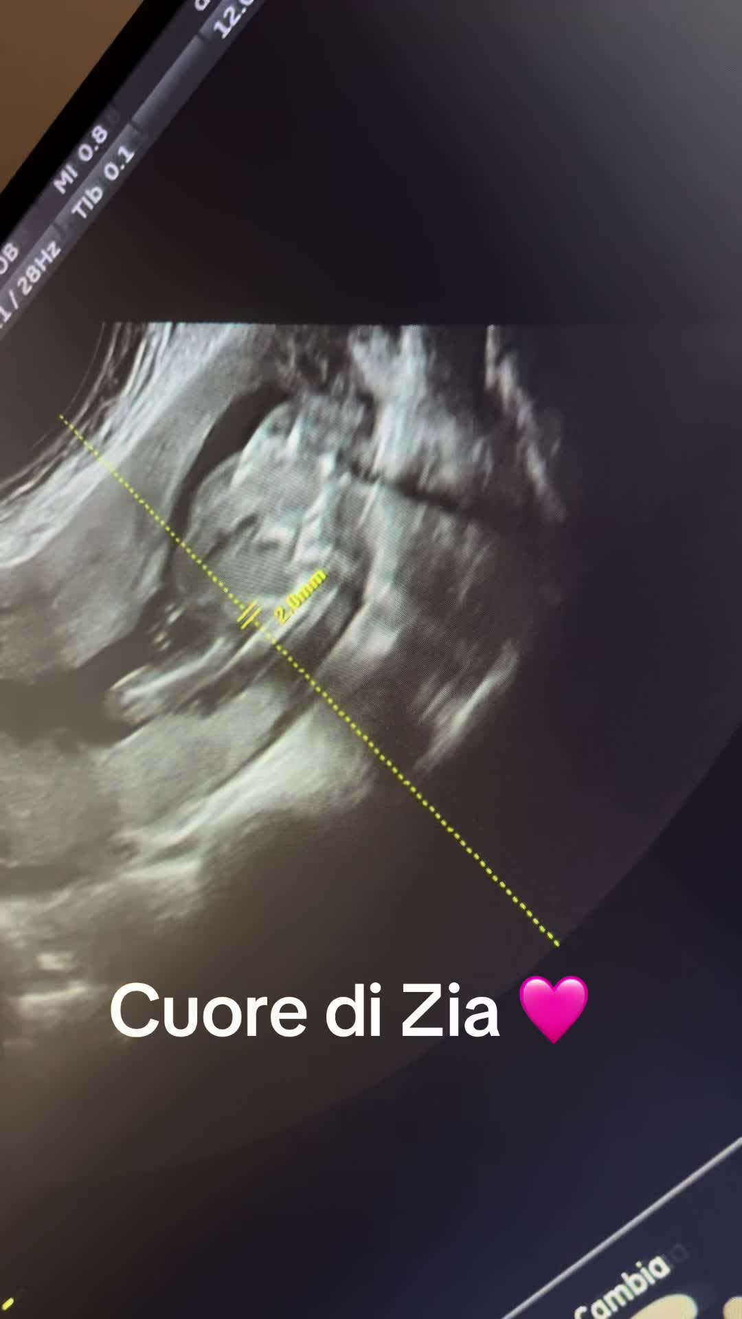 @mena.topona