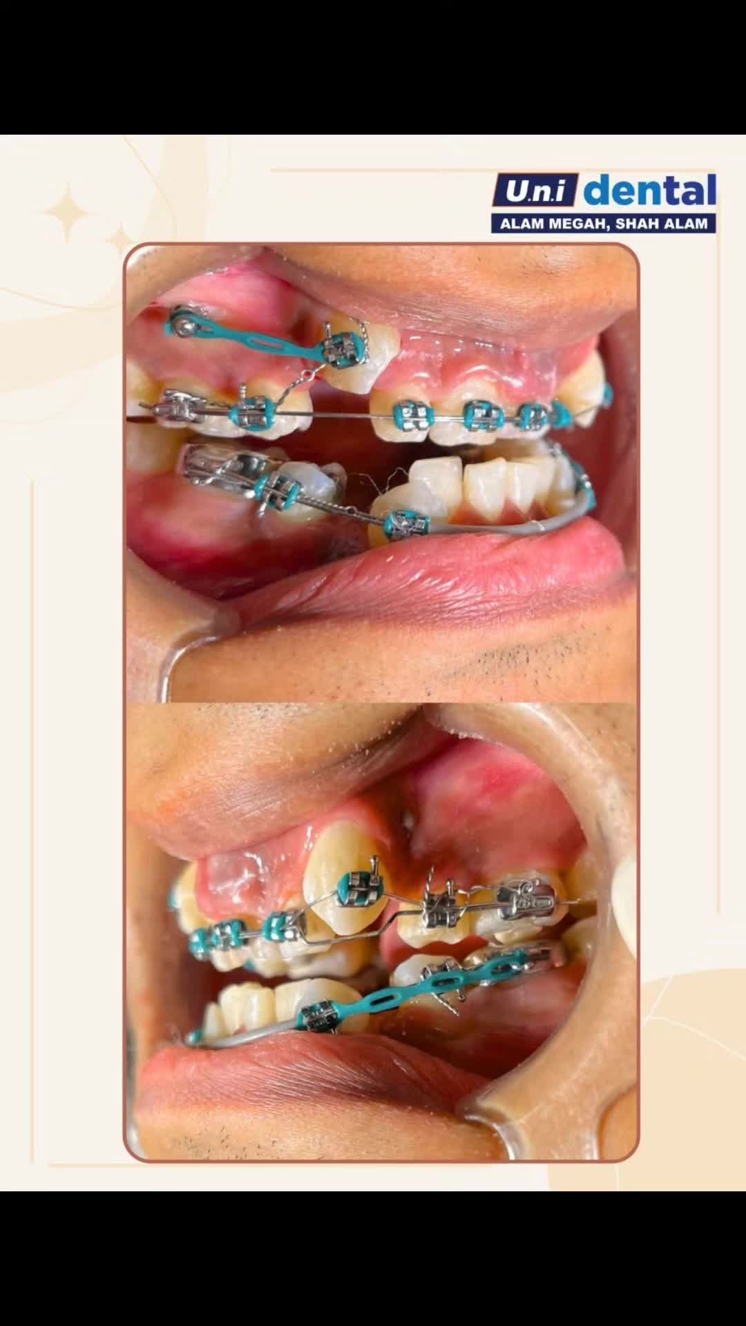 @Klinik UNI Dental Alam Megah