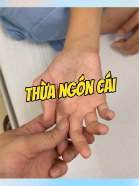 @Chuyên gia xương khớp