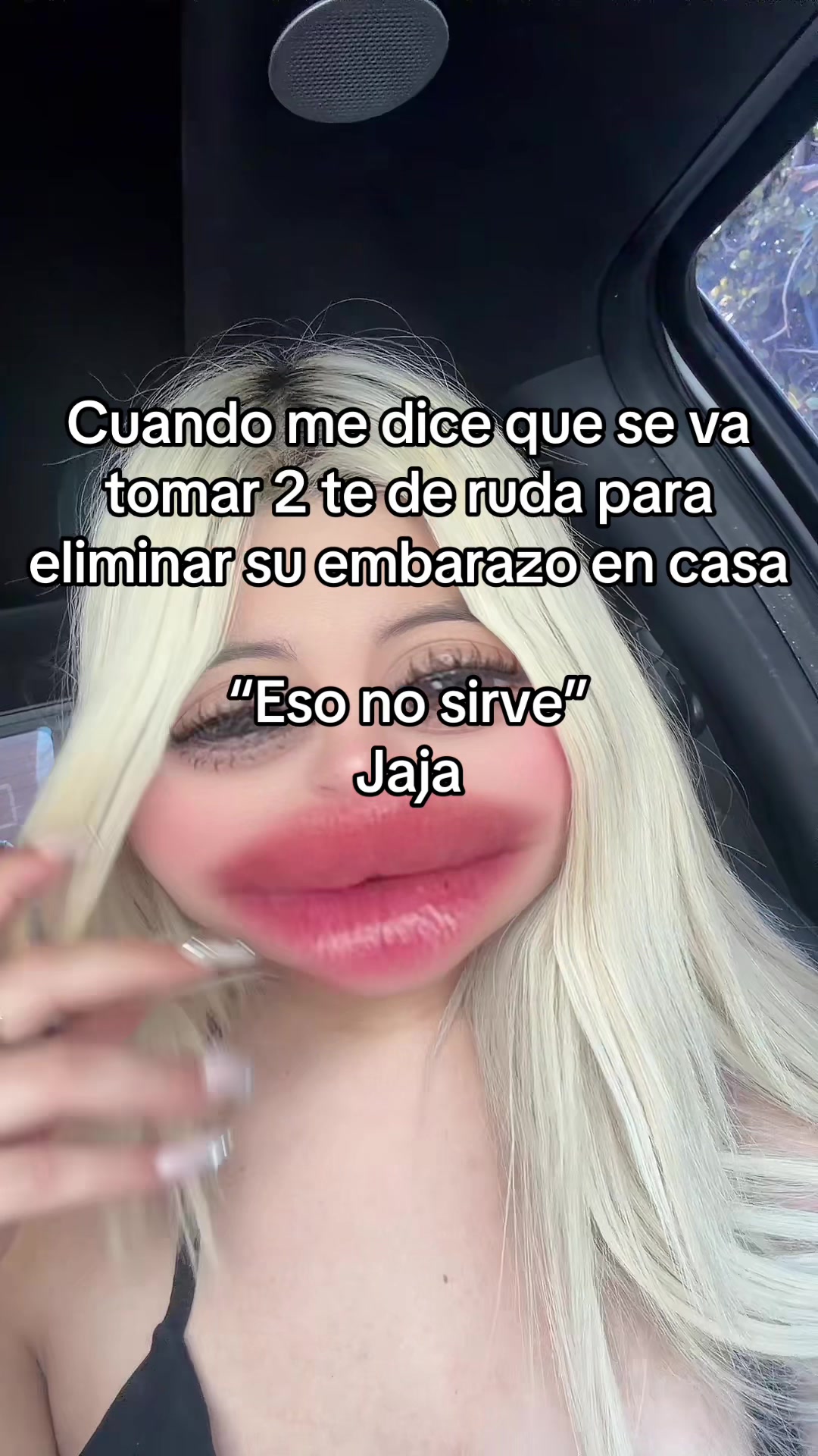@Angiie28