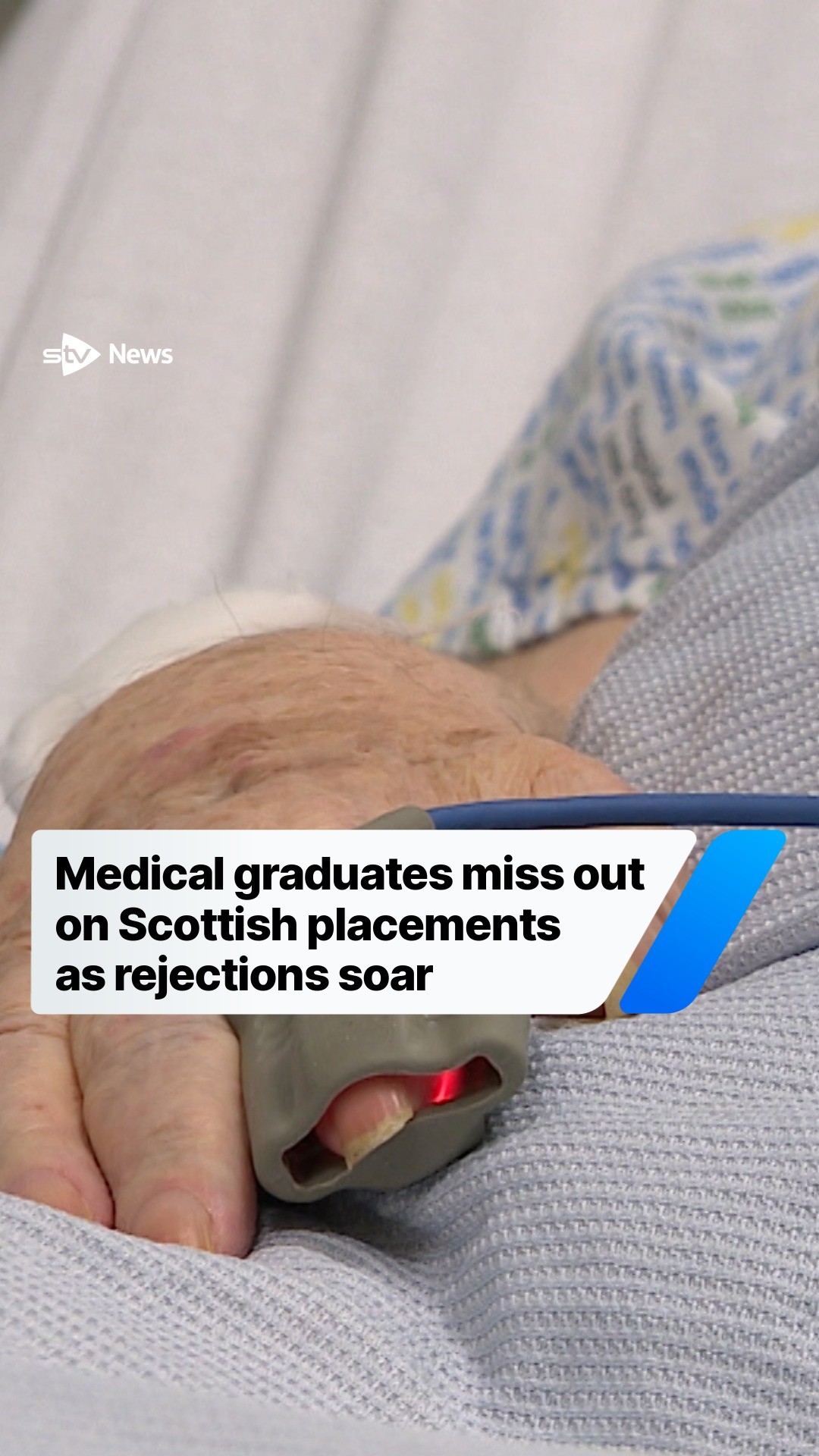 @STV News
