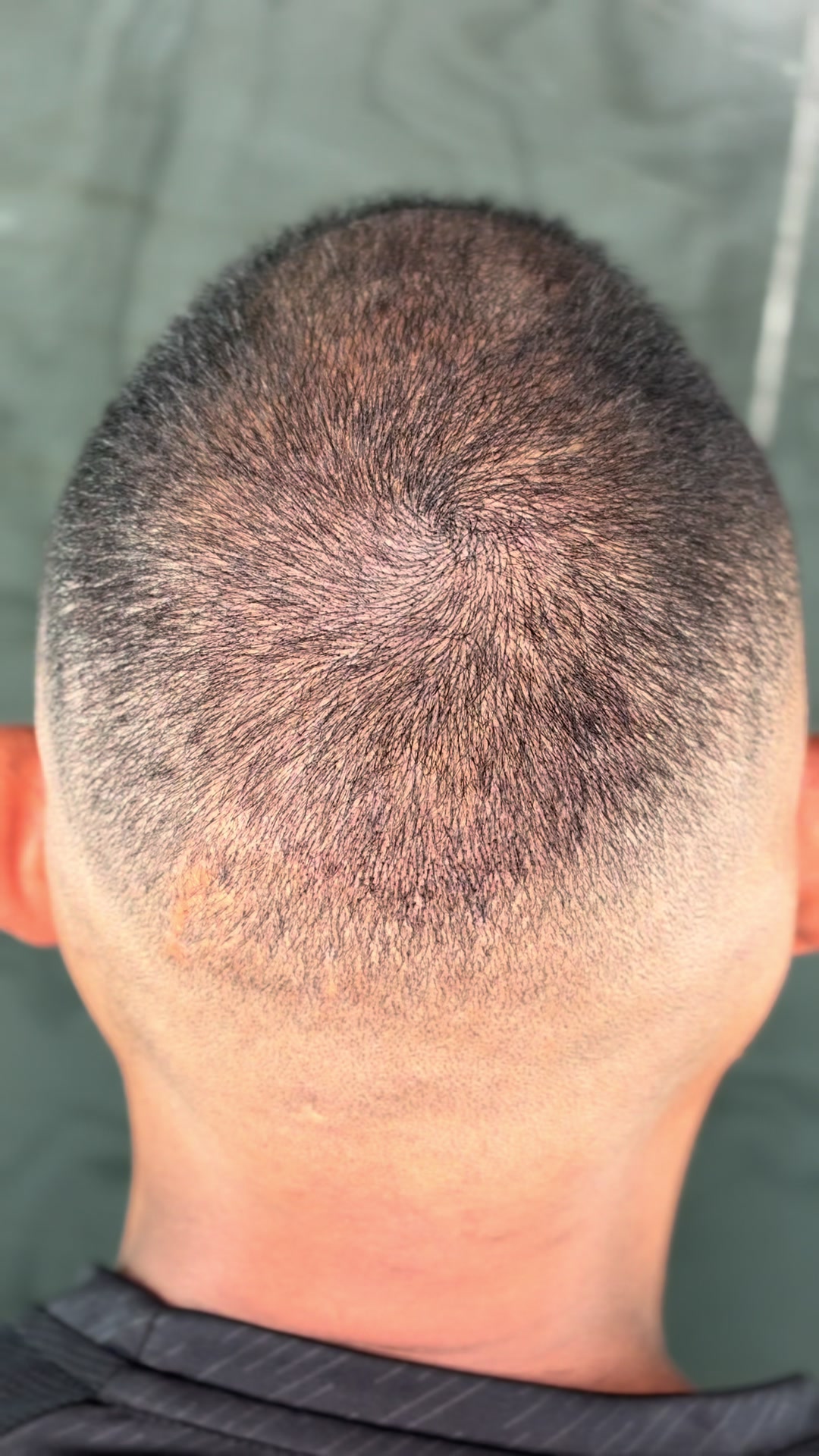 @Valesca Abi Ackel Scalp