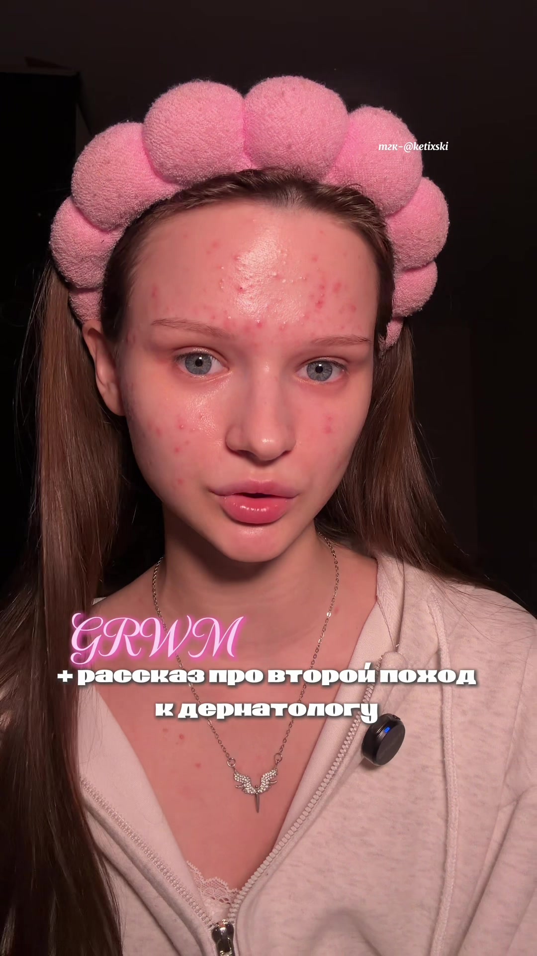 @кетикс