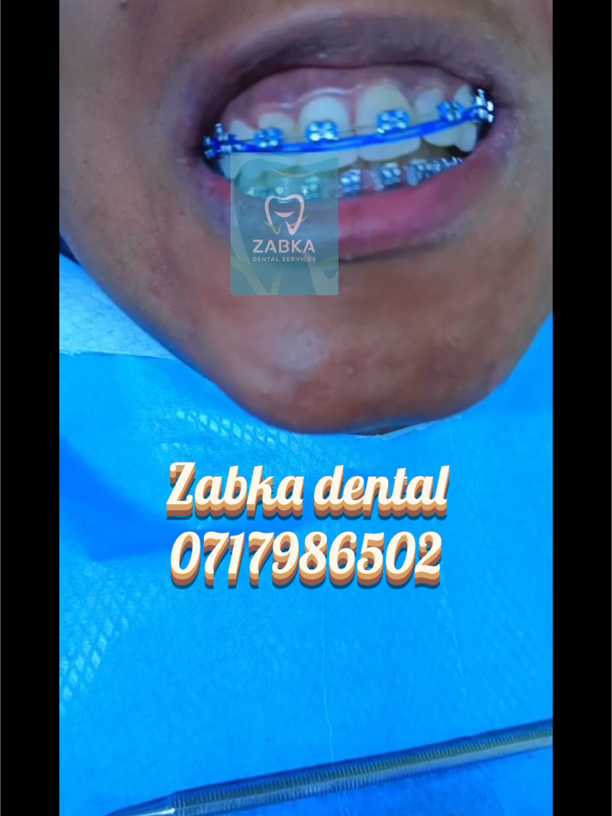 @Zabka Dental