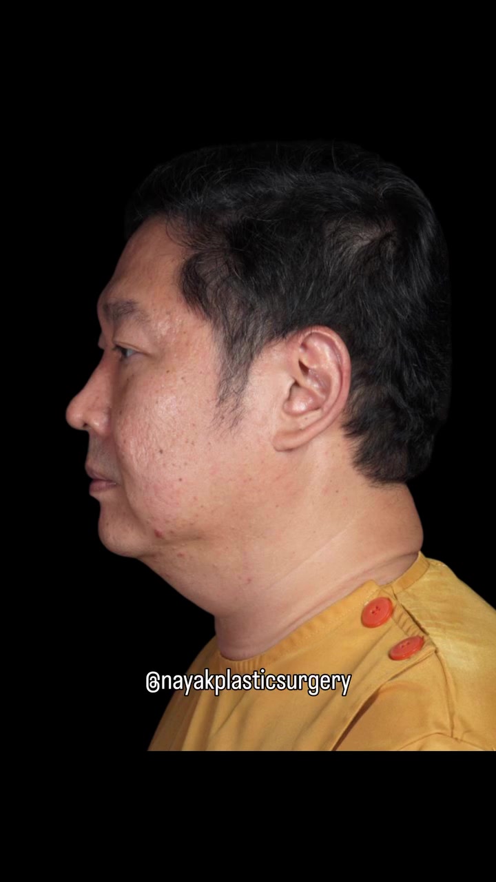 @NayakPlasticSurgery