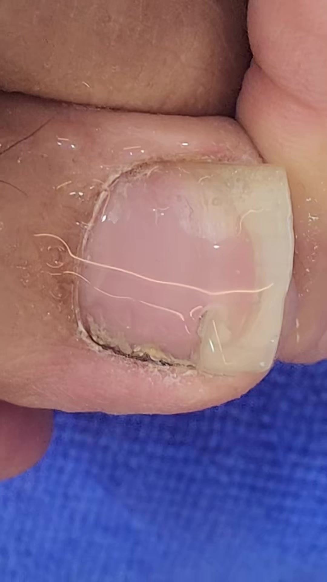 @Toenails.clips