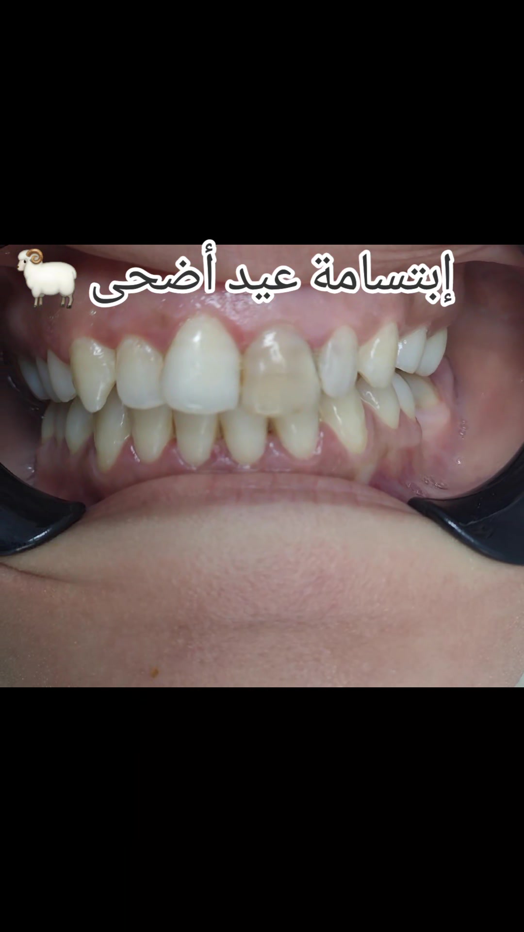@Dr otmani. A 🦷🖤
