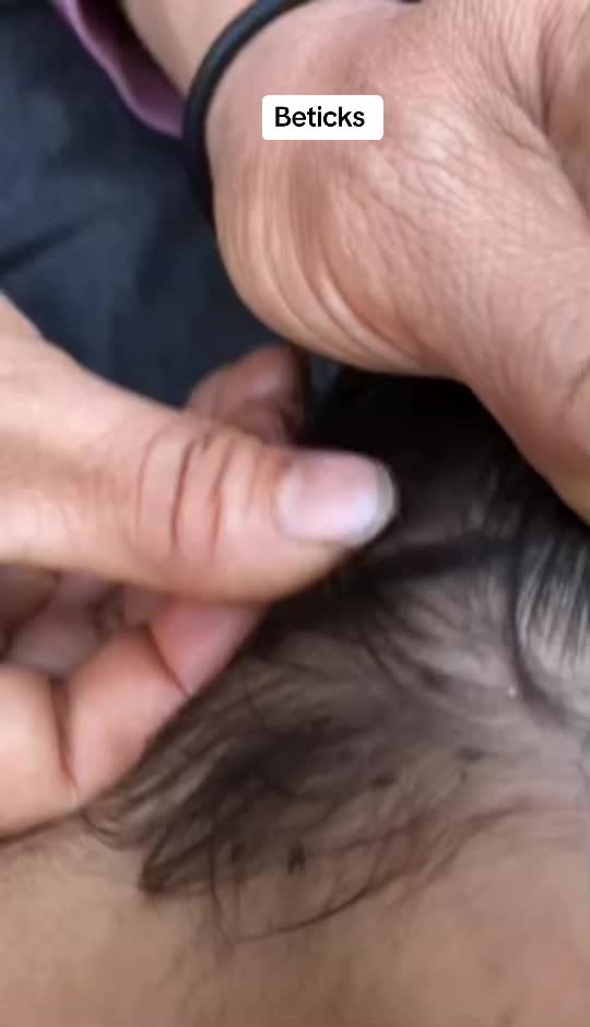 @bbbeee195