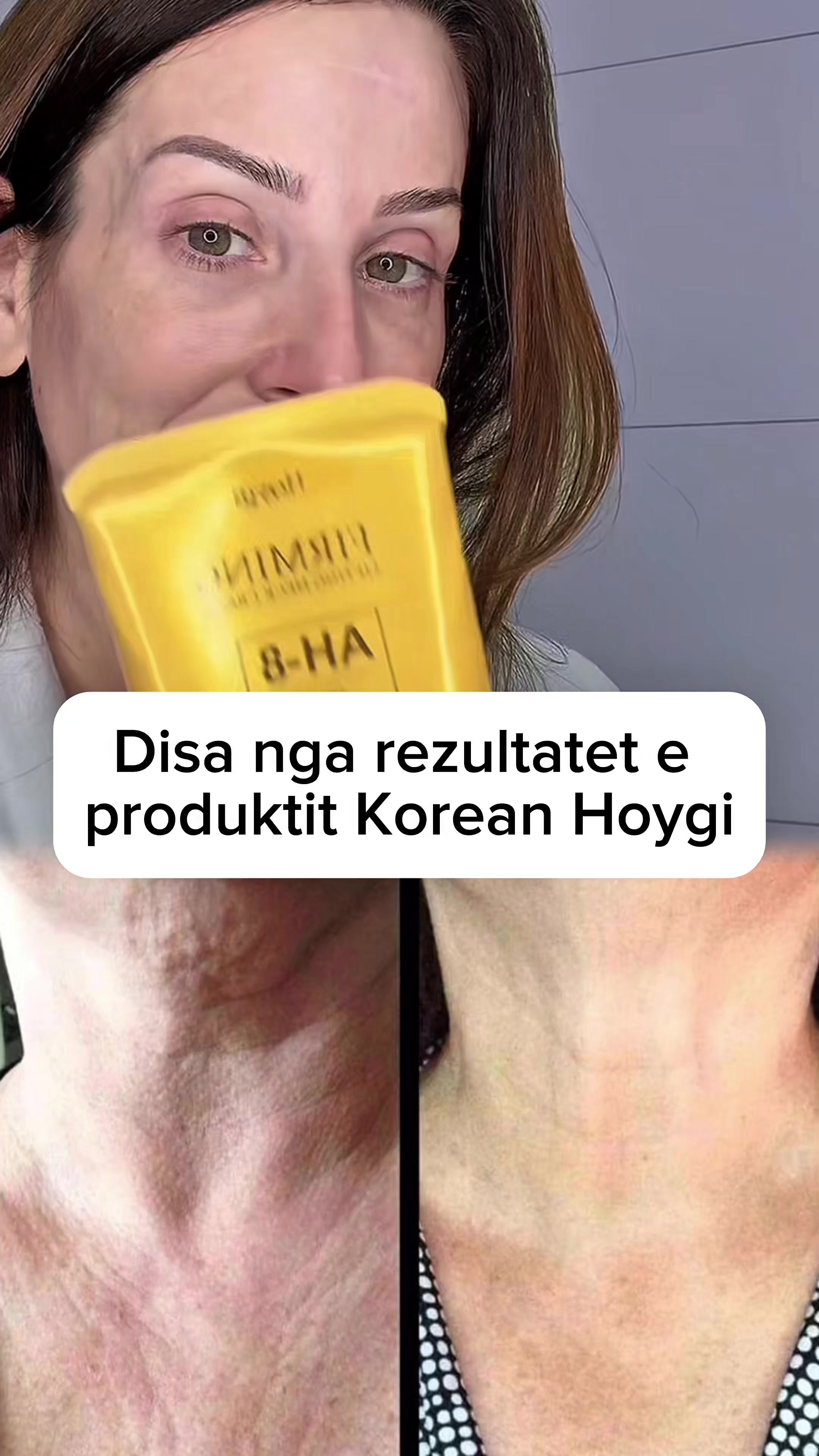@Lumar