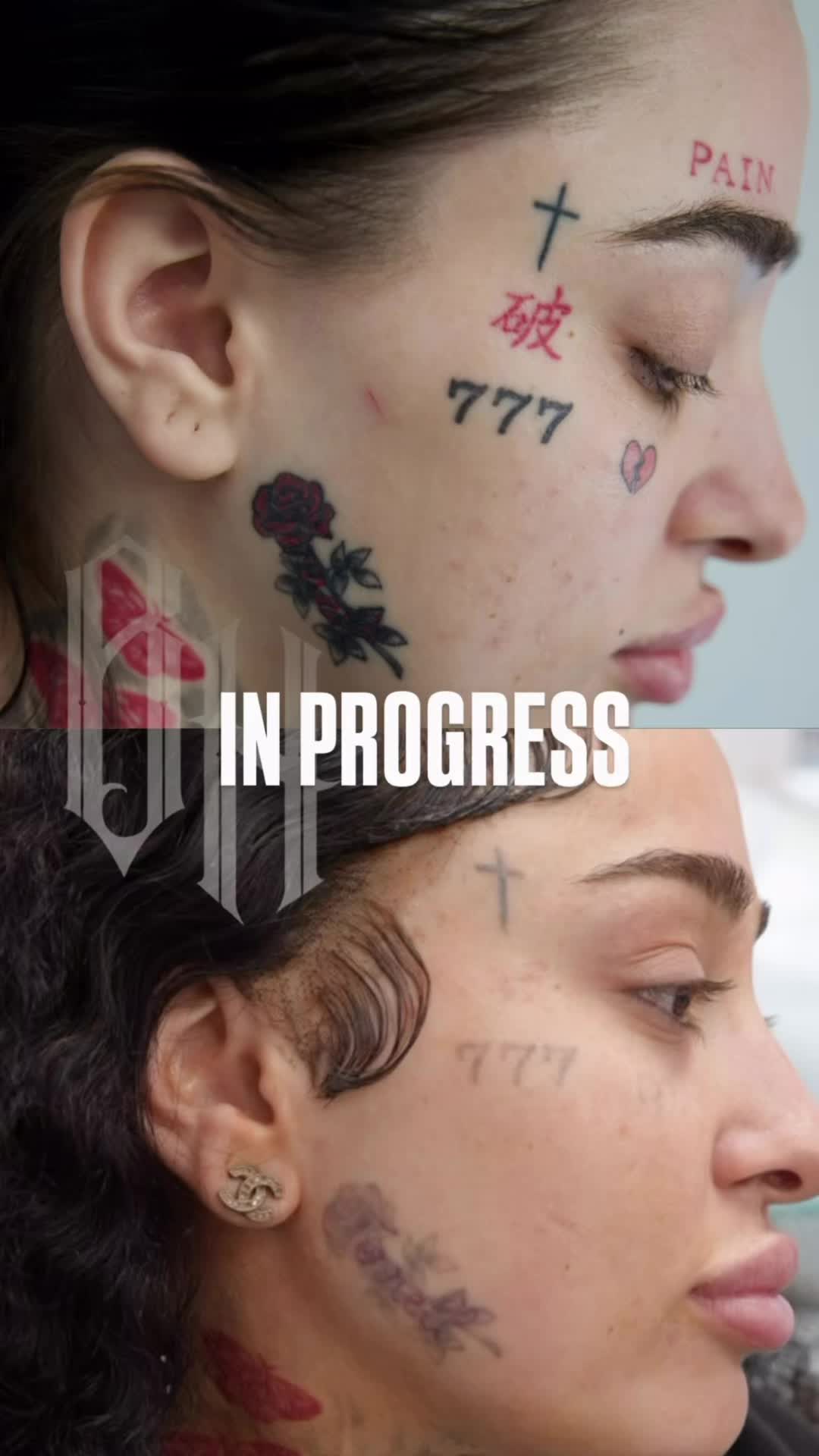 @@BHLASERTATTOOREMOVAL