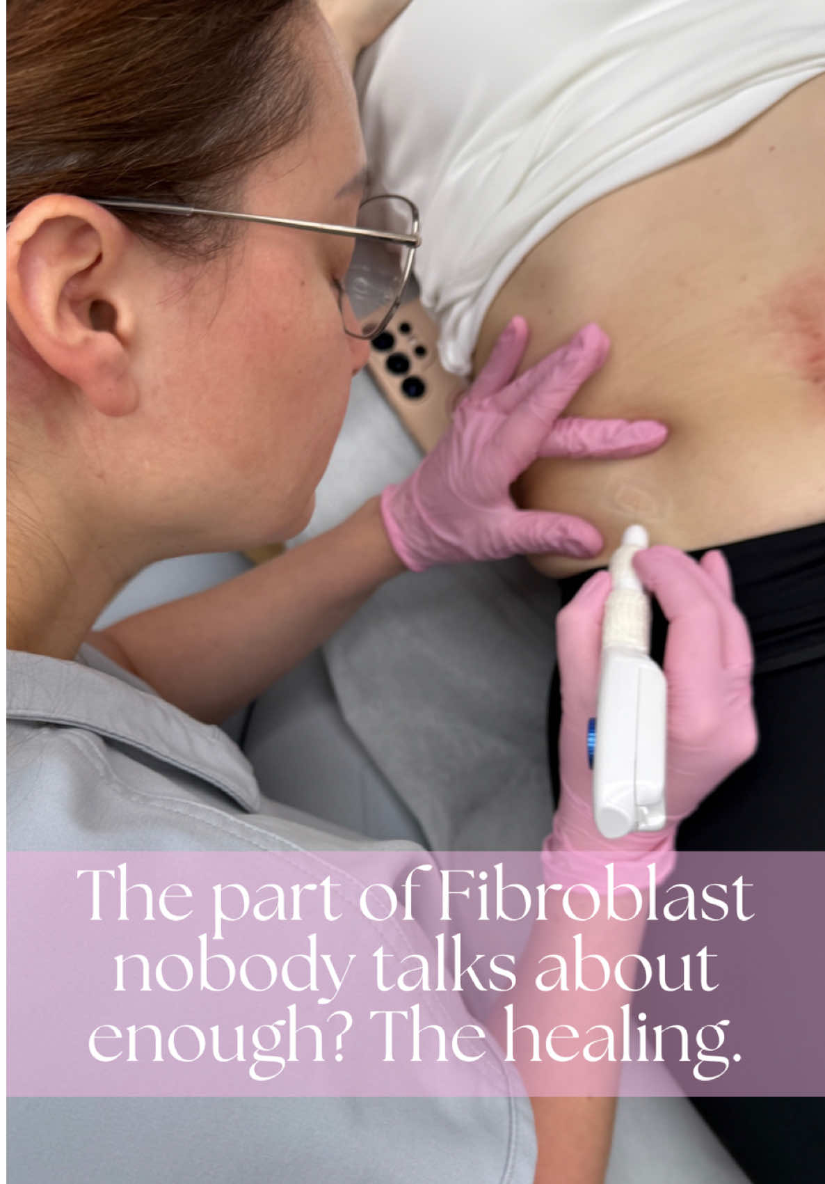 @ib_therapy