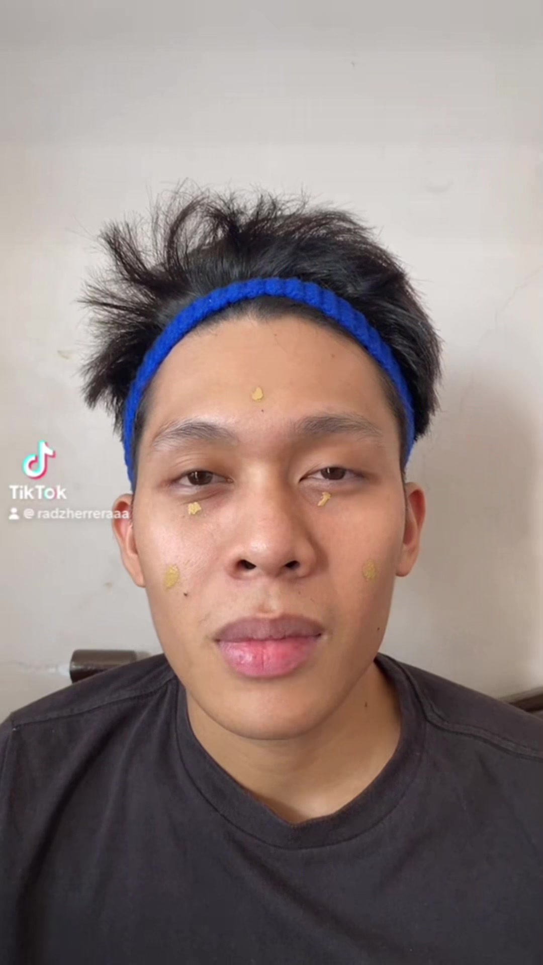 @๐ฑ๐๐