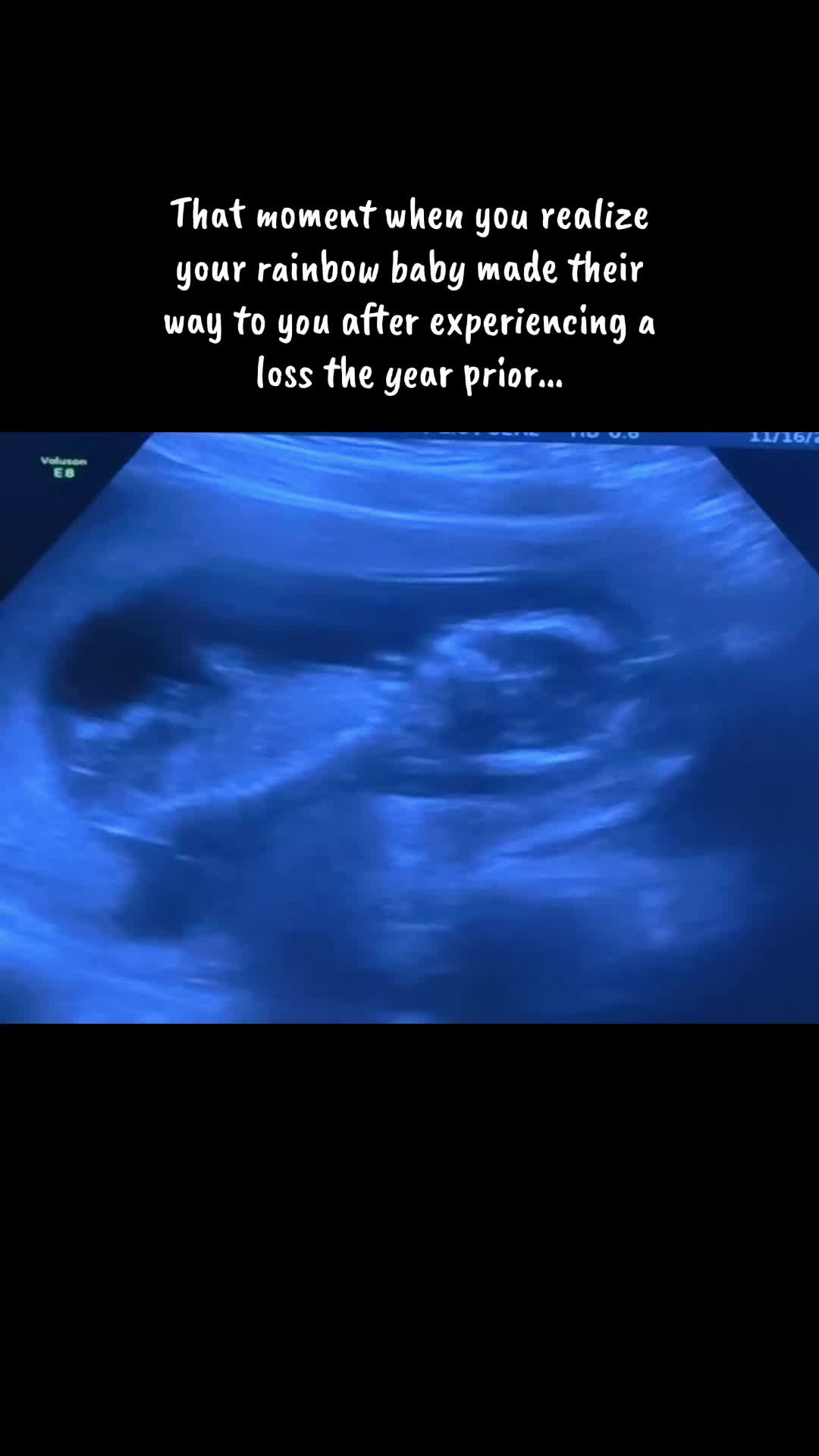 @S