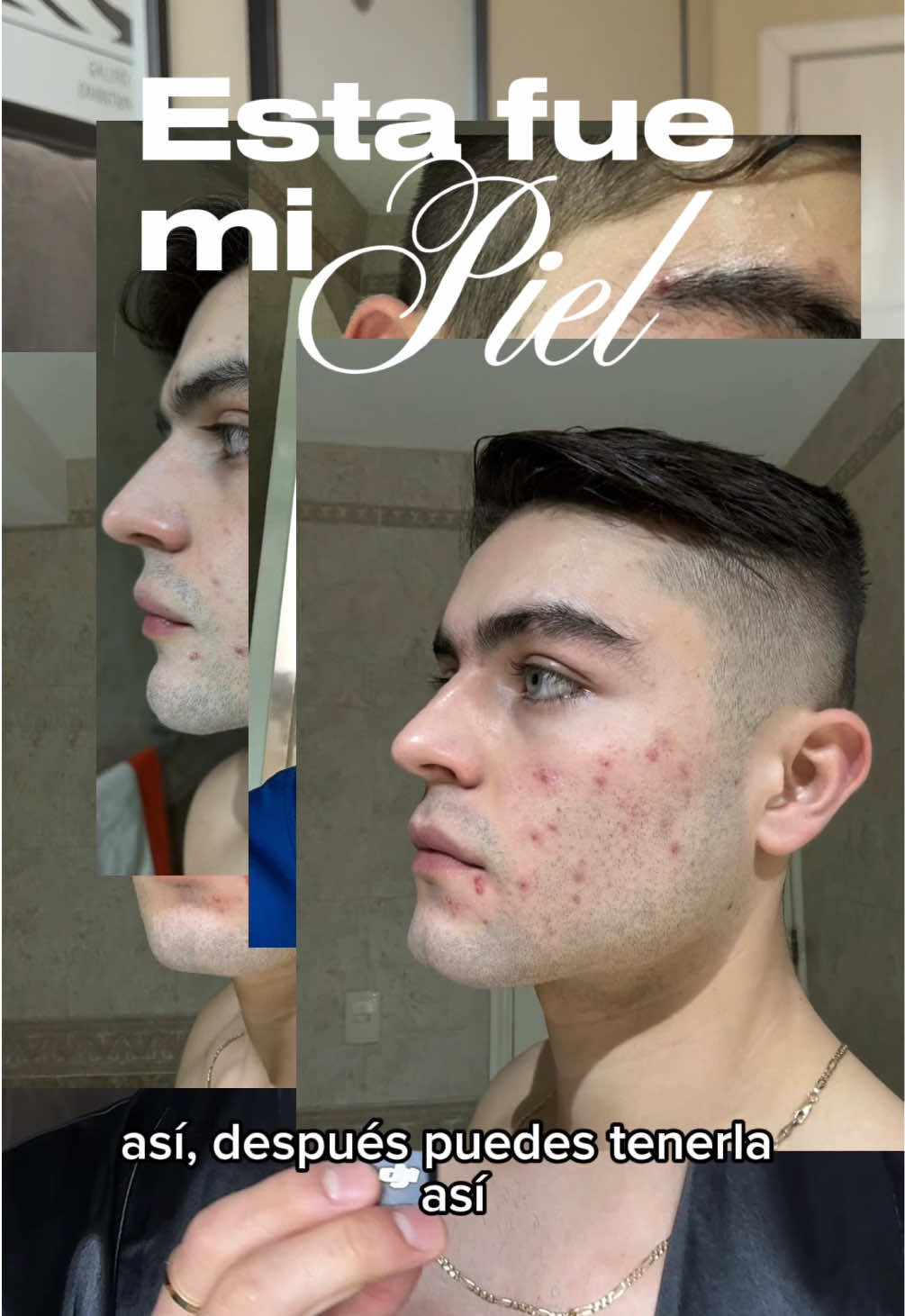 @Michael Miranda