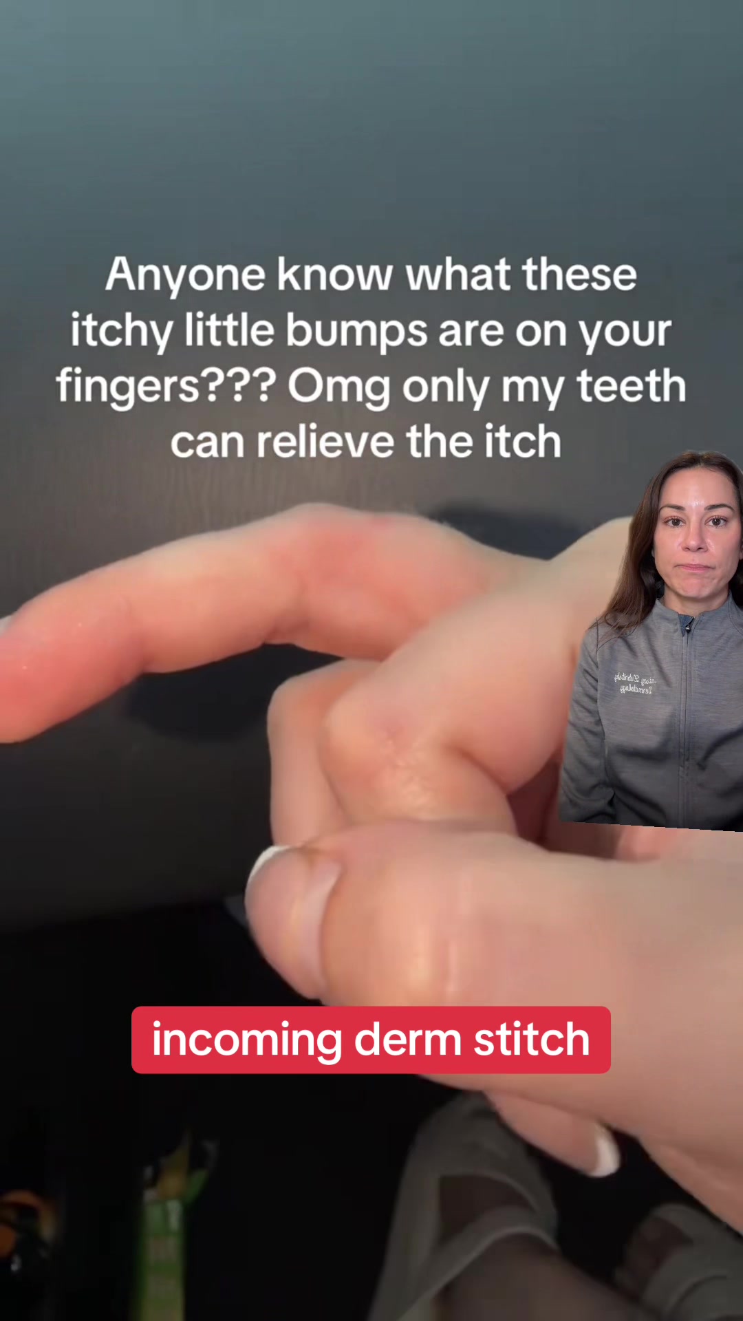@Dermguru