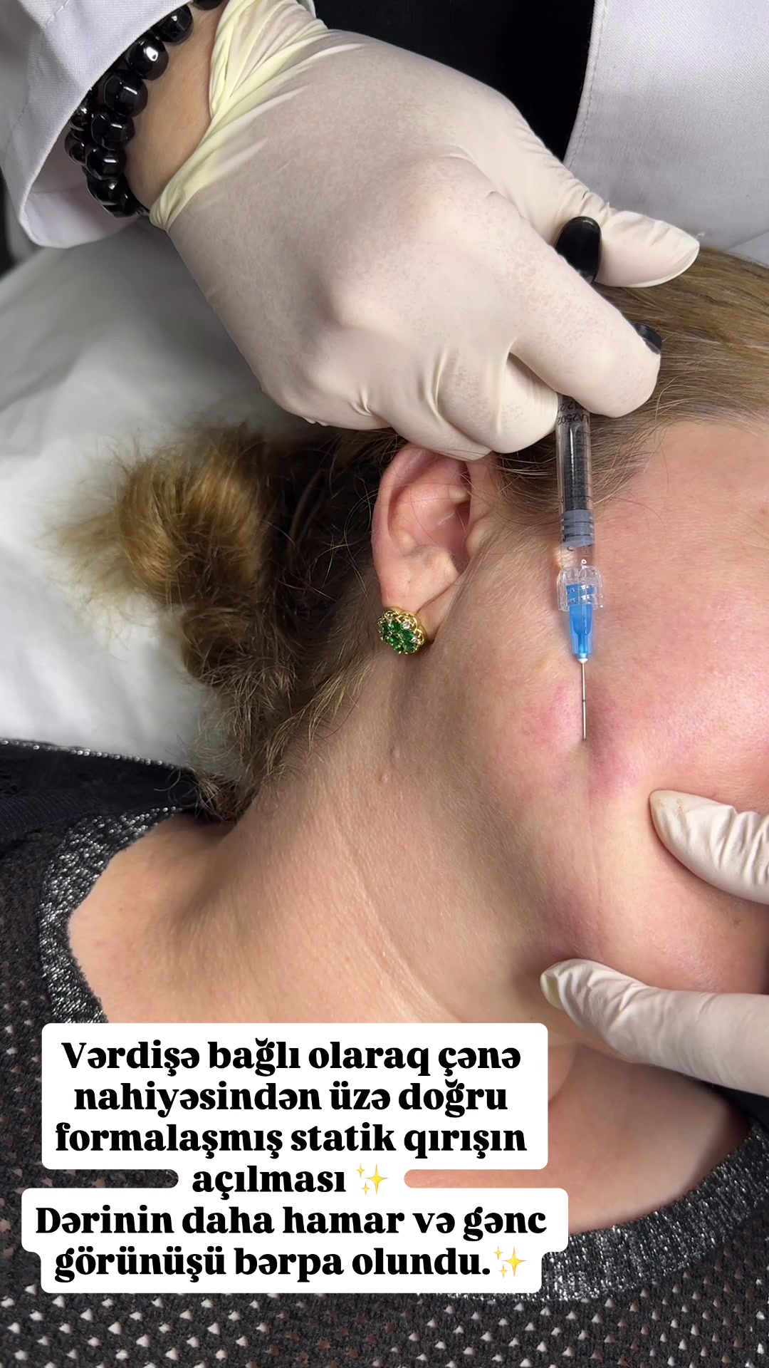@Dr.kemale.nazarli Dermatoloq