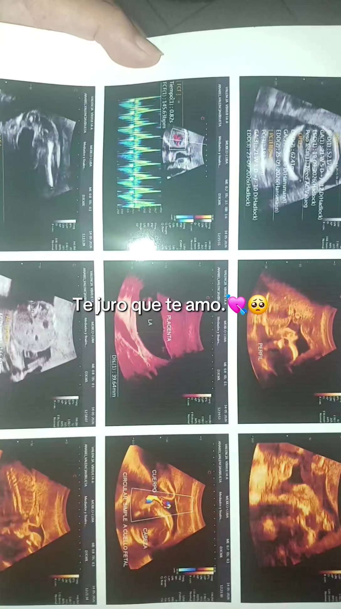 @🐣❤️🅰.PARA DEDICAR..💘E❤️