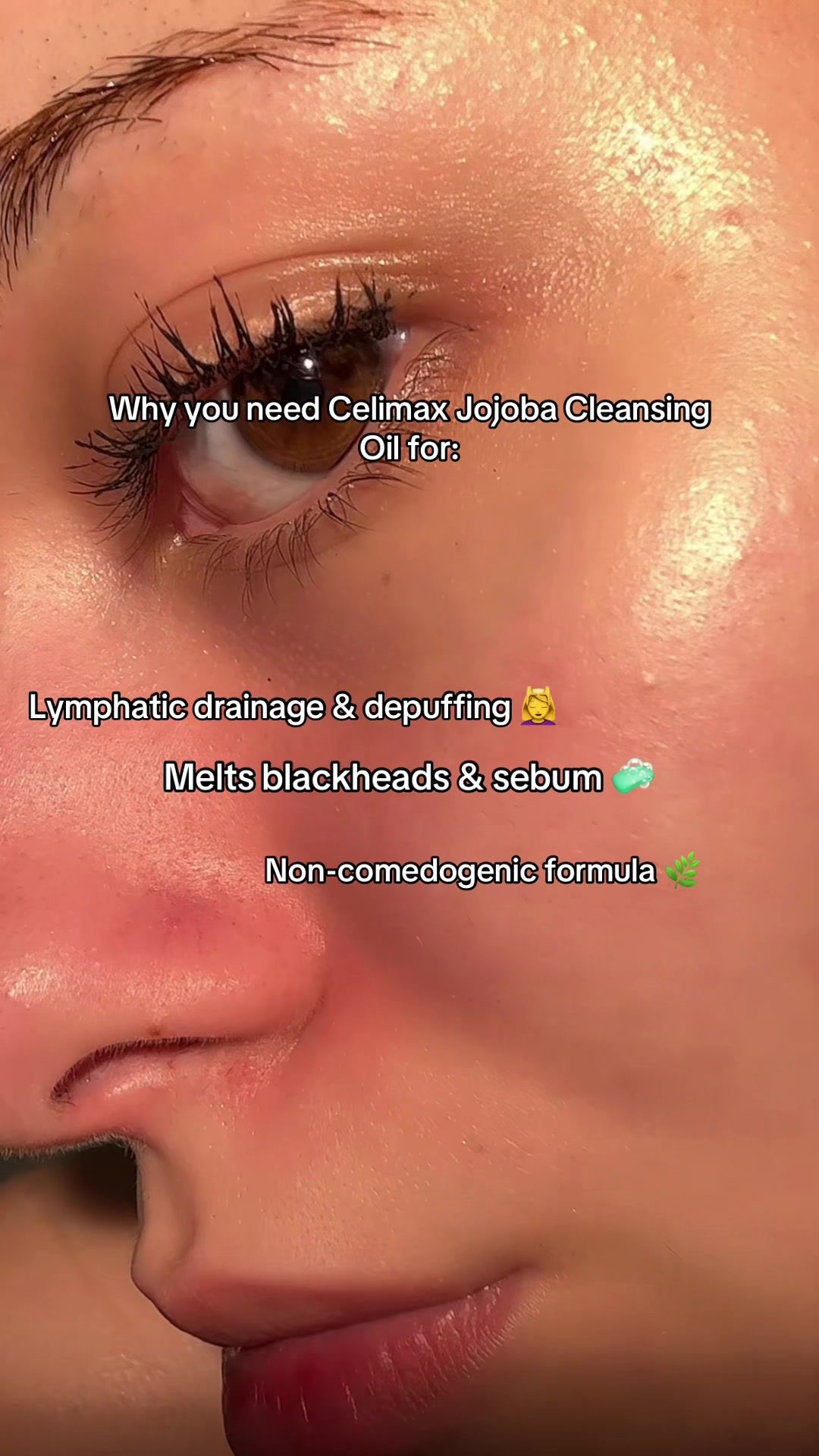 @ananiklas