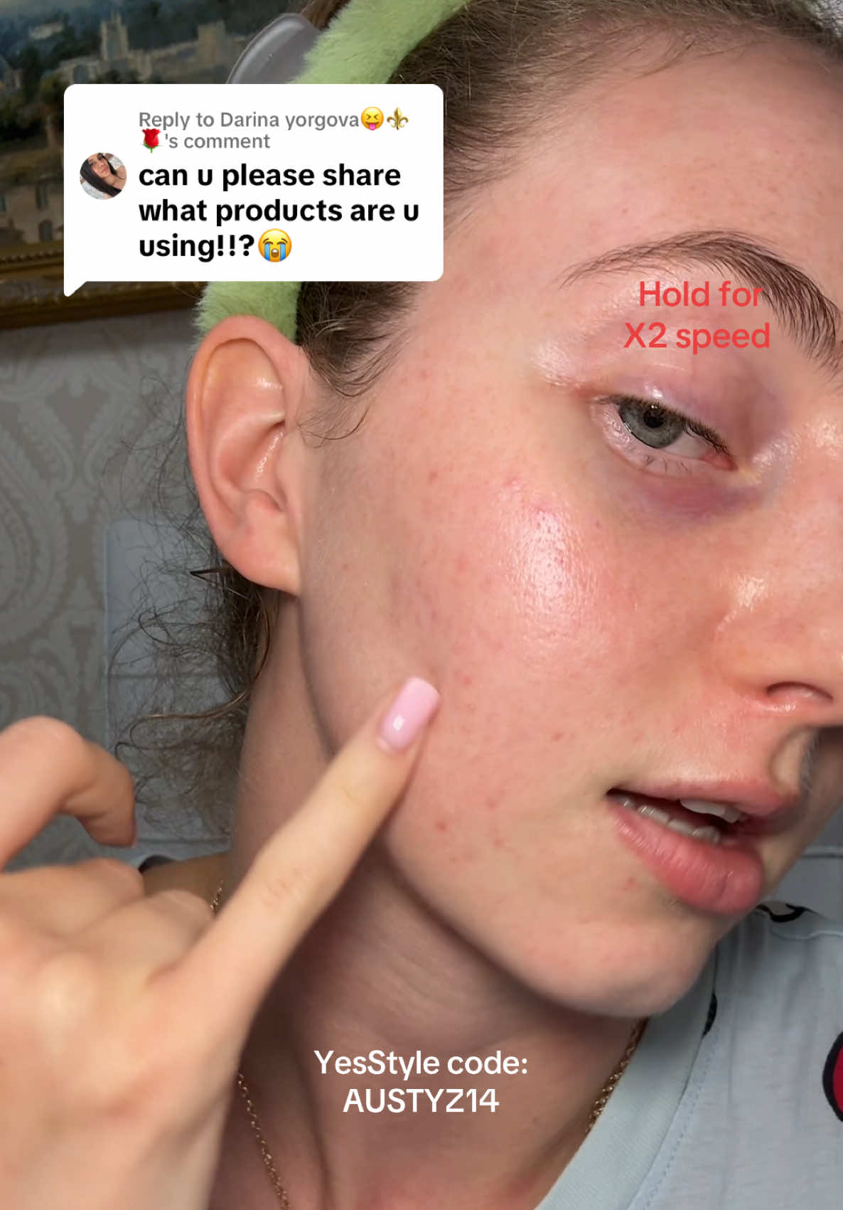 @Austeja 🍄✨🐸