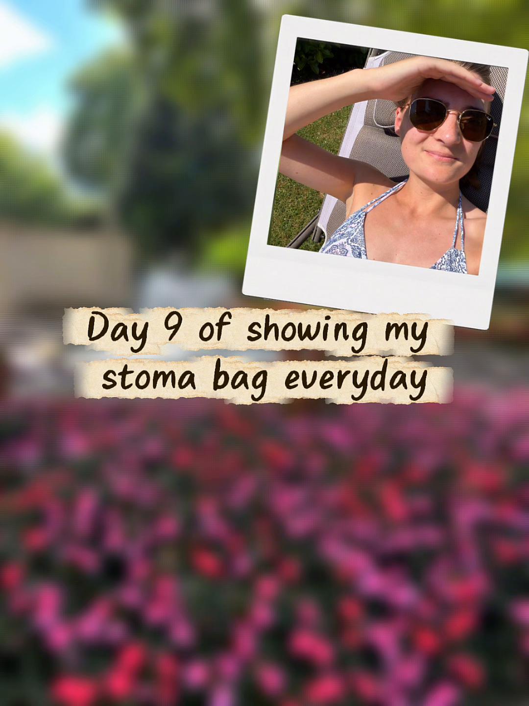 @Louise | Stoma & Crohns