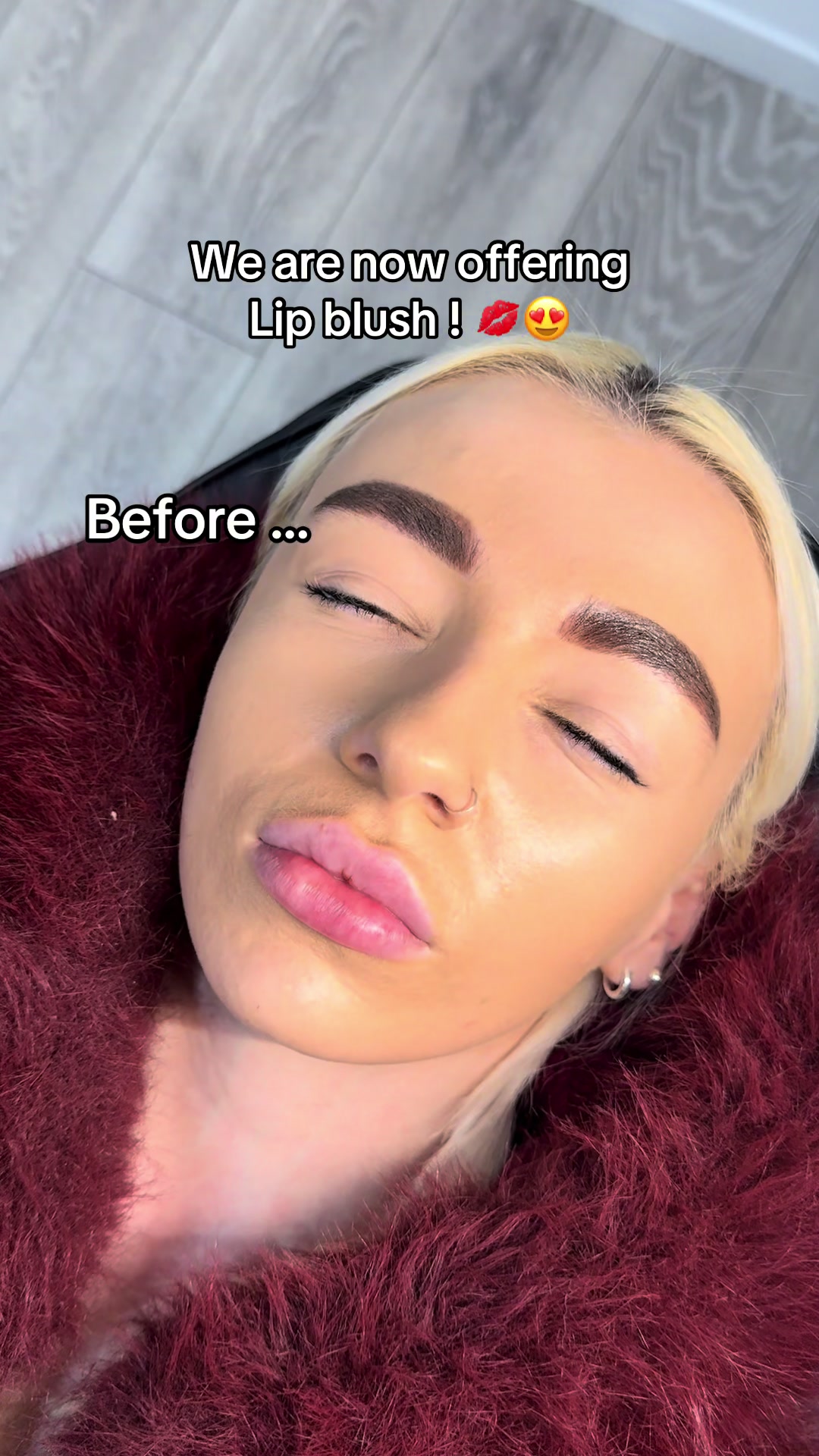 @face_ncl