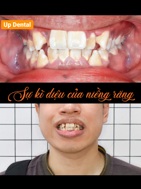 @Nha khoa niềng răng Up Dental