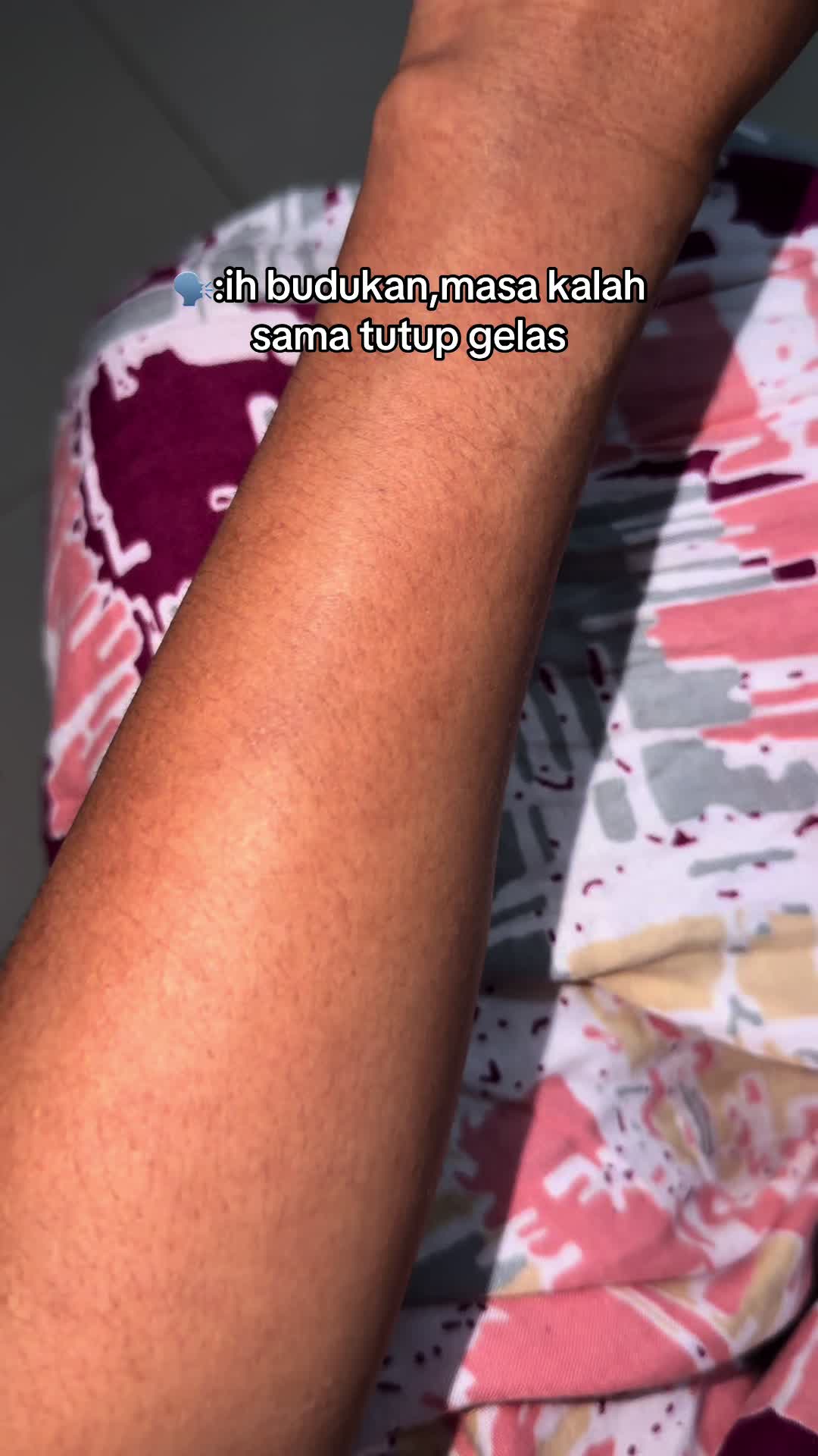 @Zimong🍉🤏🏼