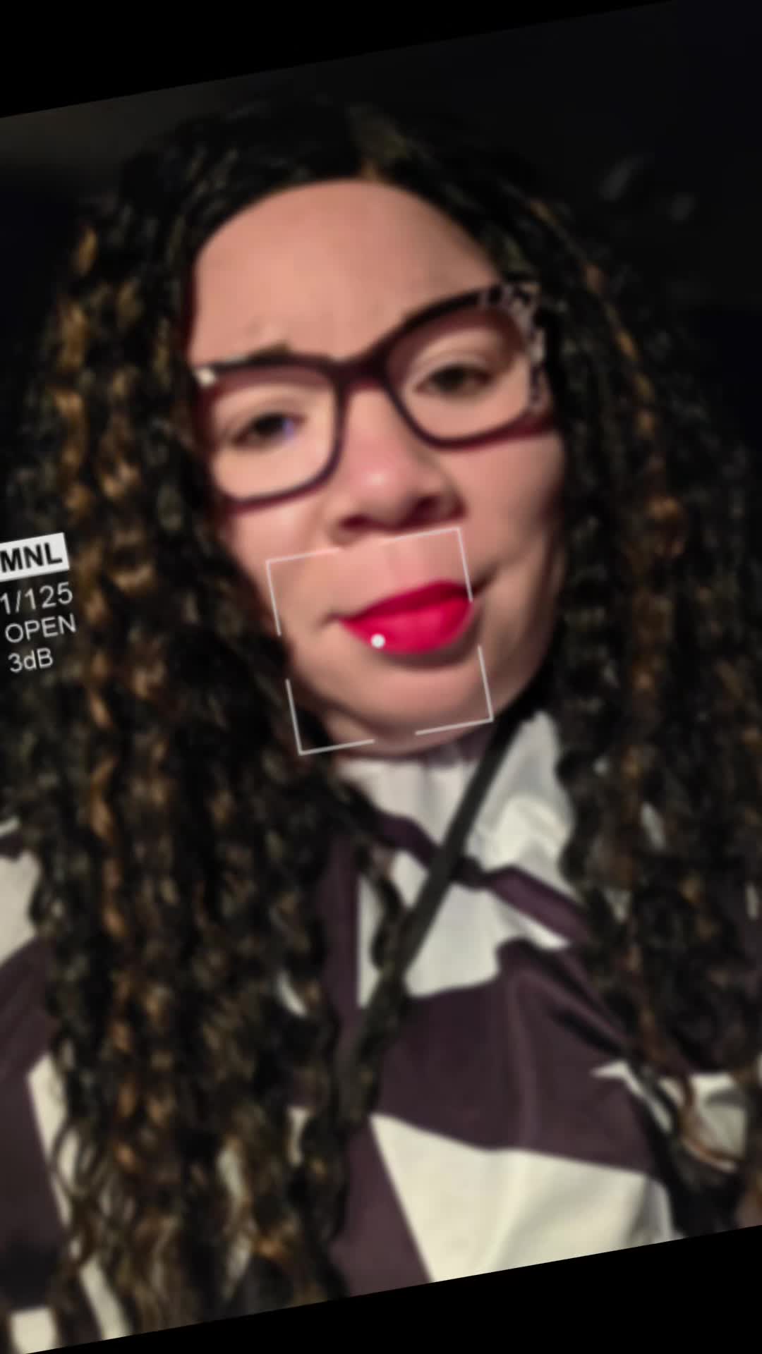 @Miss. PinkY(vitiligo girl)