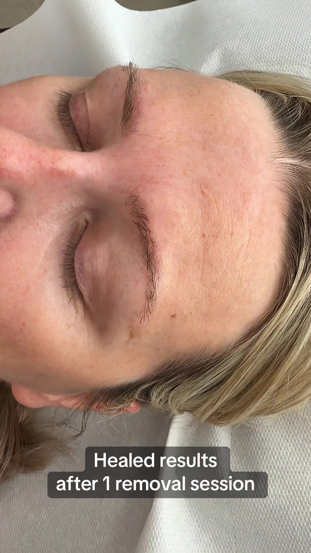 @Permanent Makeup & Removal