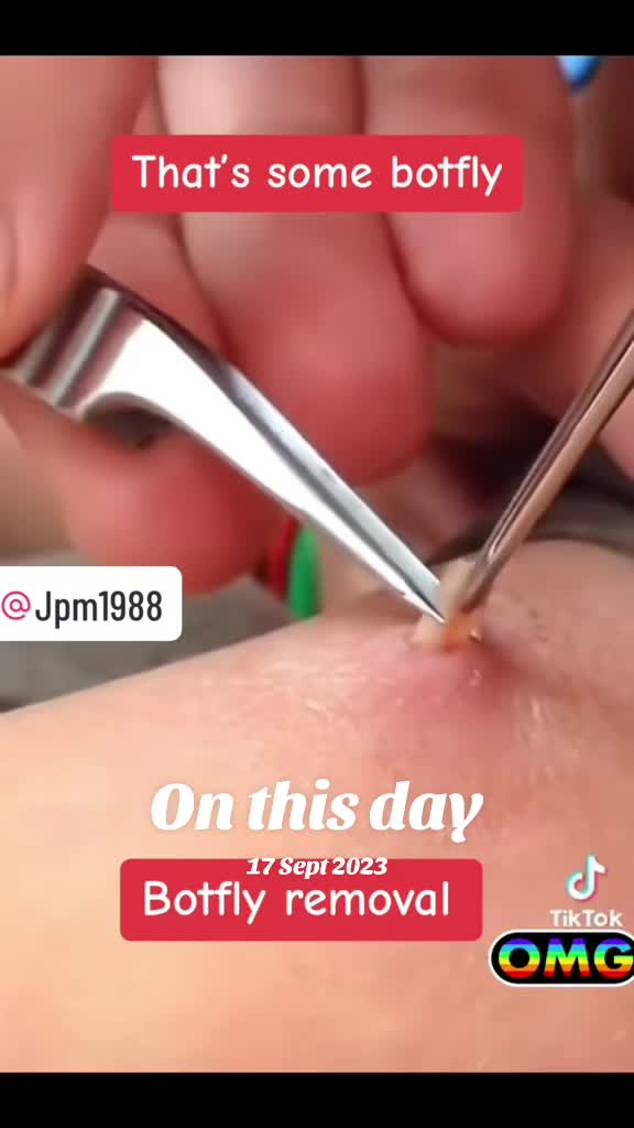 @jpm19880