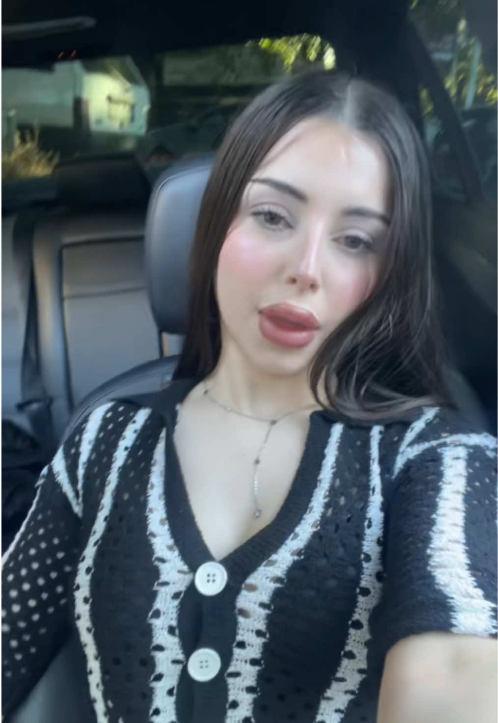 @ß