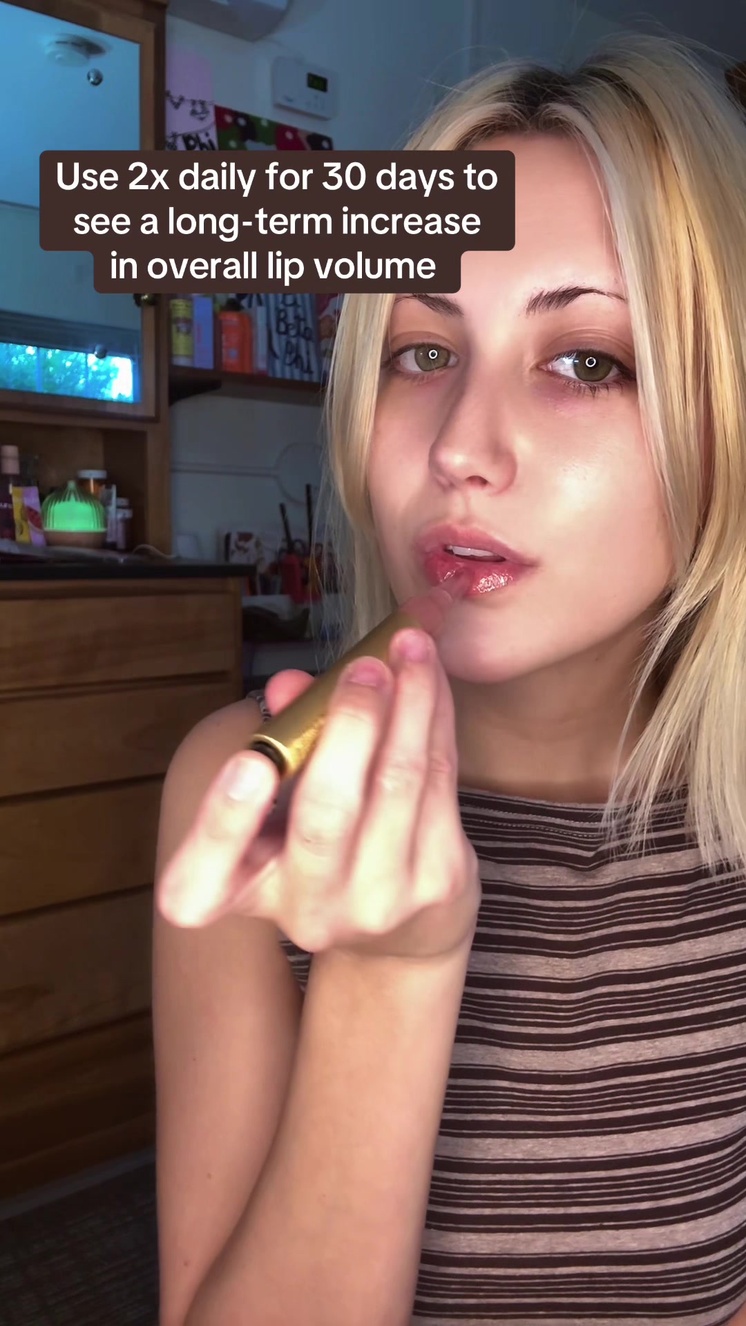 @hypermobilitydiaries