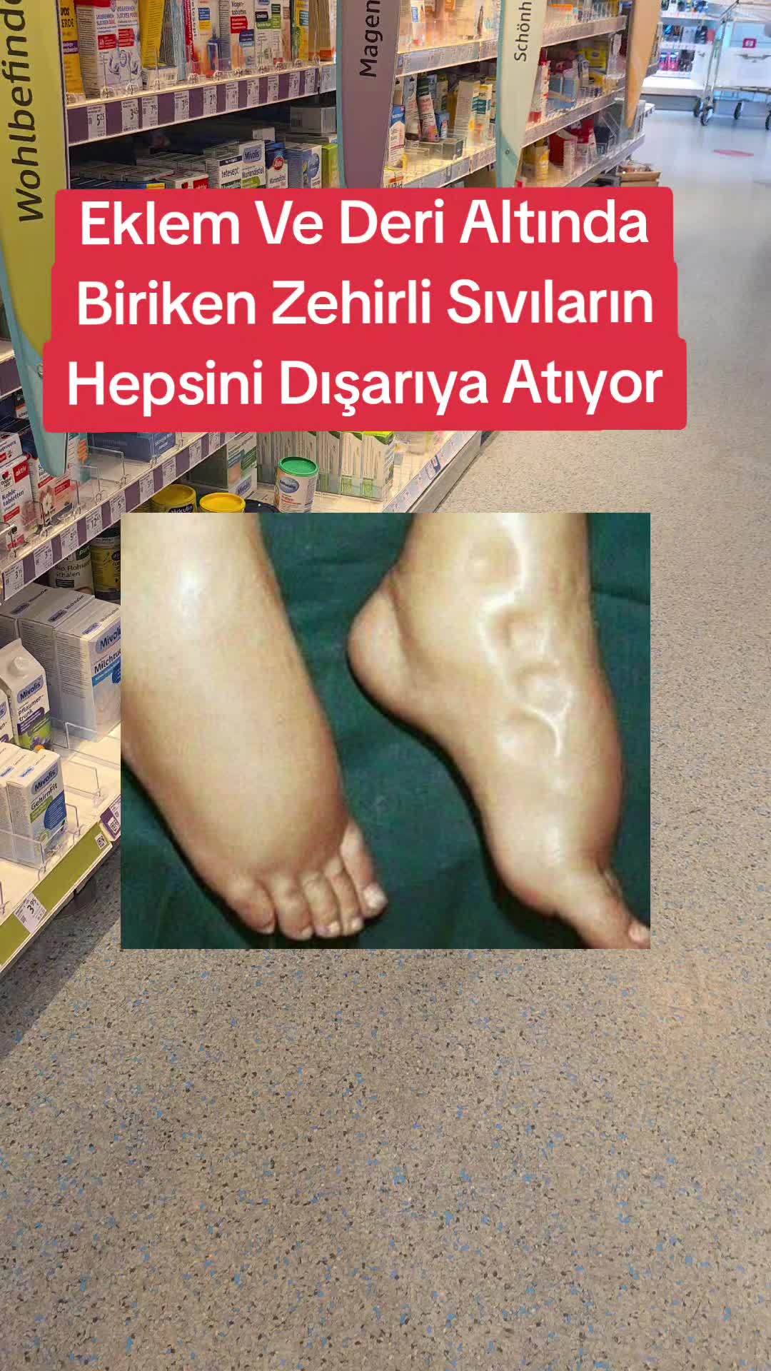 @Gurbetana27