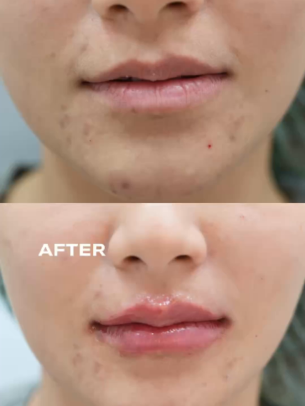 @Standard Skin clinic