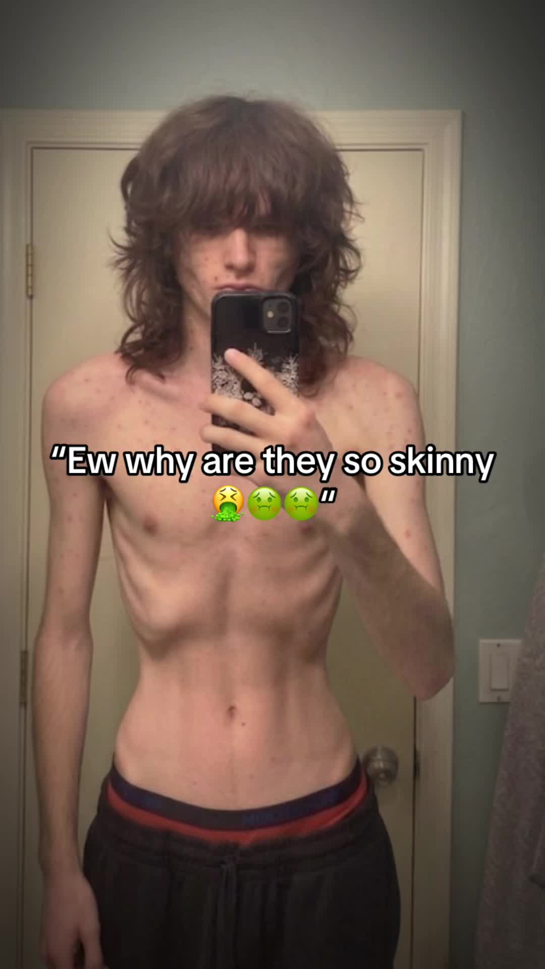 @Quackildick