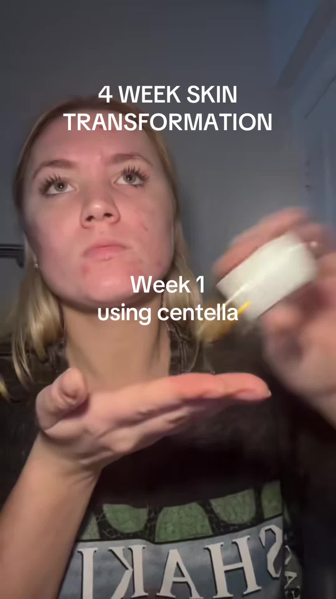 @bellytts