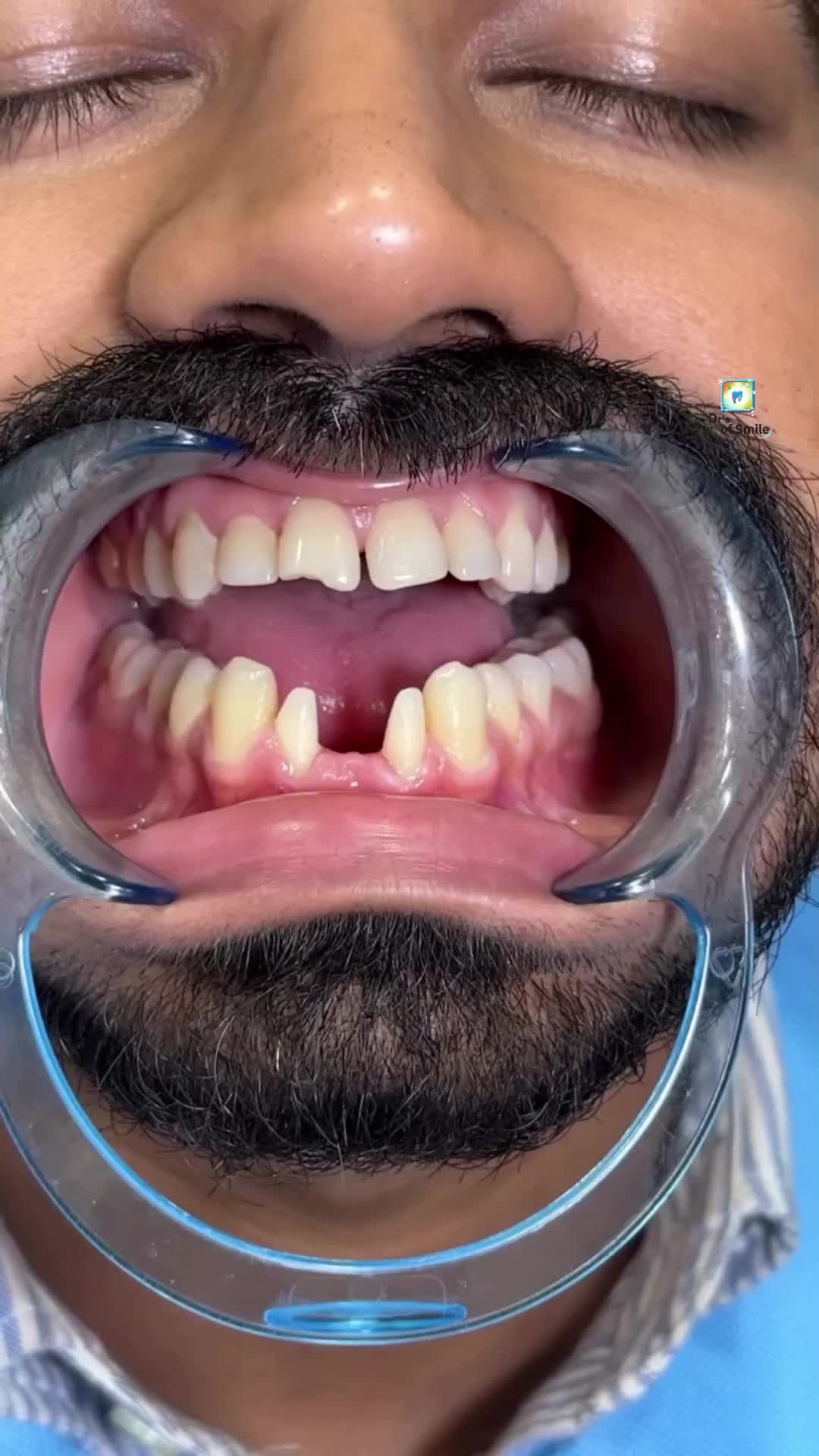 @𝗗𝗿'𝘀 𝗢𝗳 𝗦𝗺𝗶𝗹𝗲🦷🧑⚕️