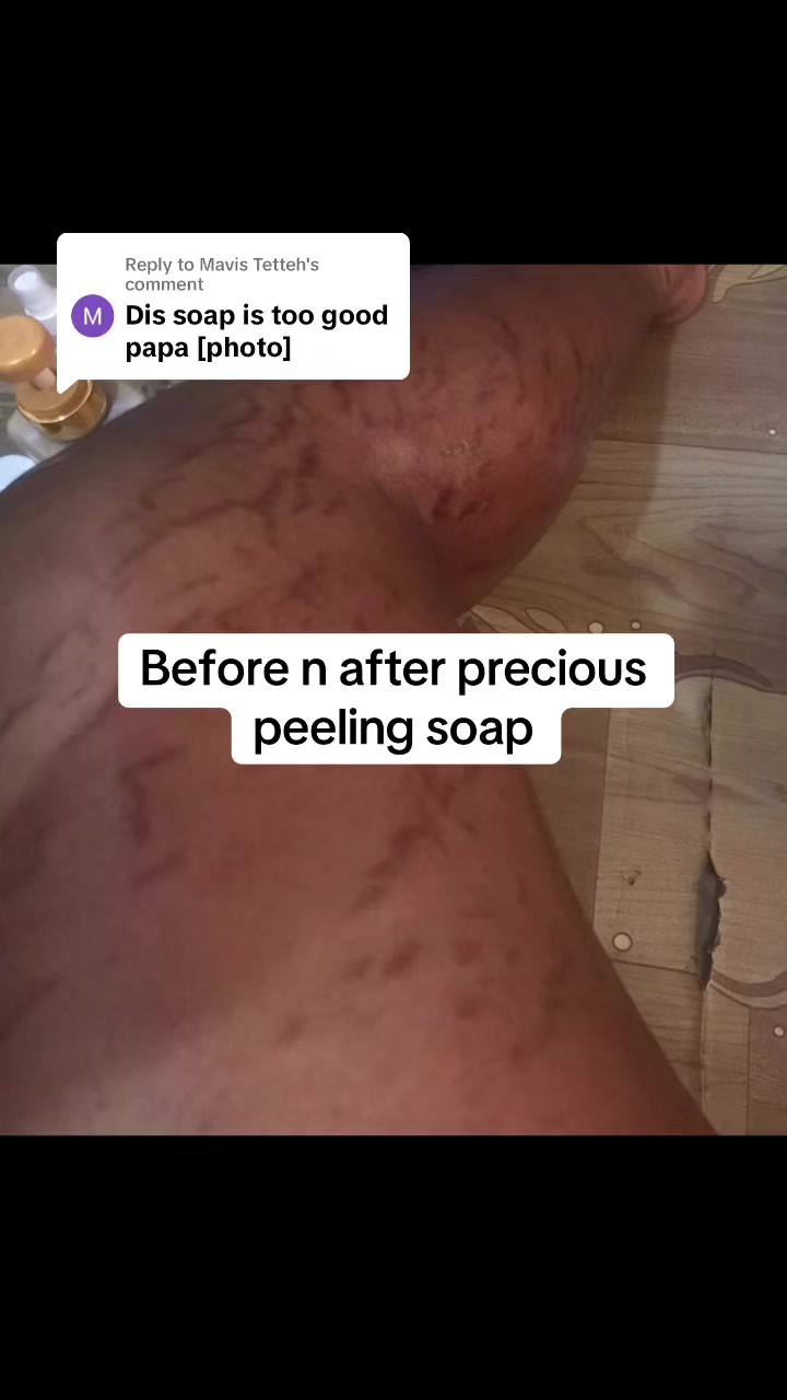 @@ Precious peeling soap