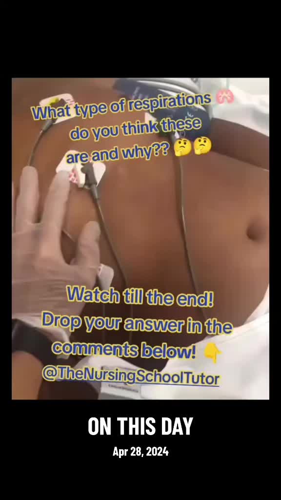 @Advance nurse mi