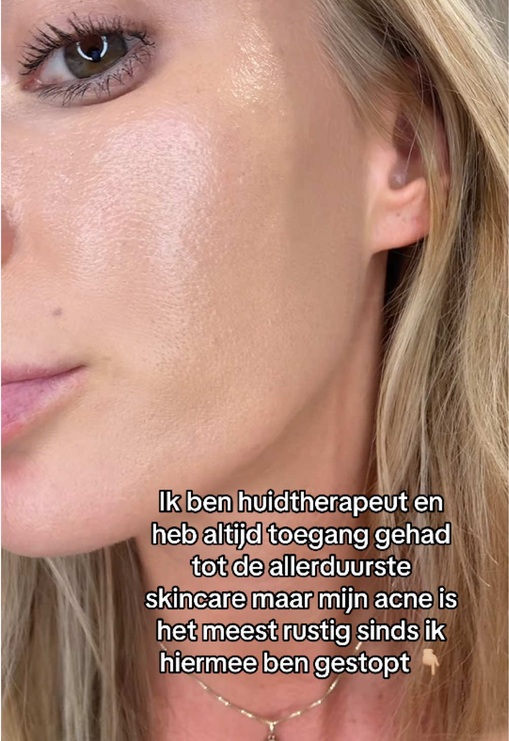 @Skinfixer